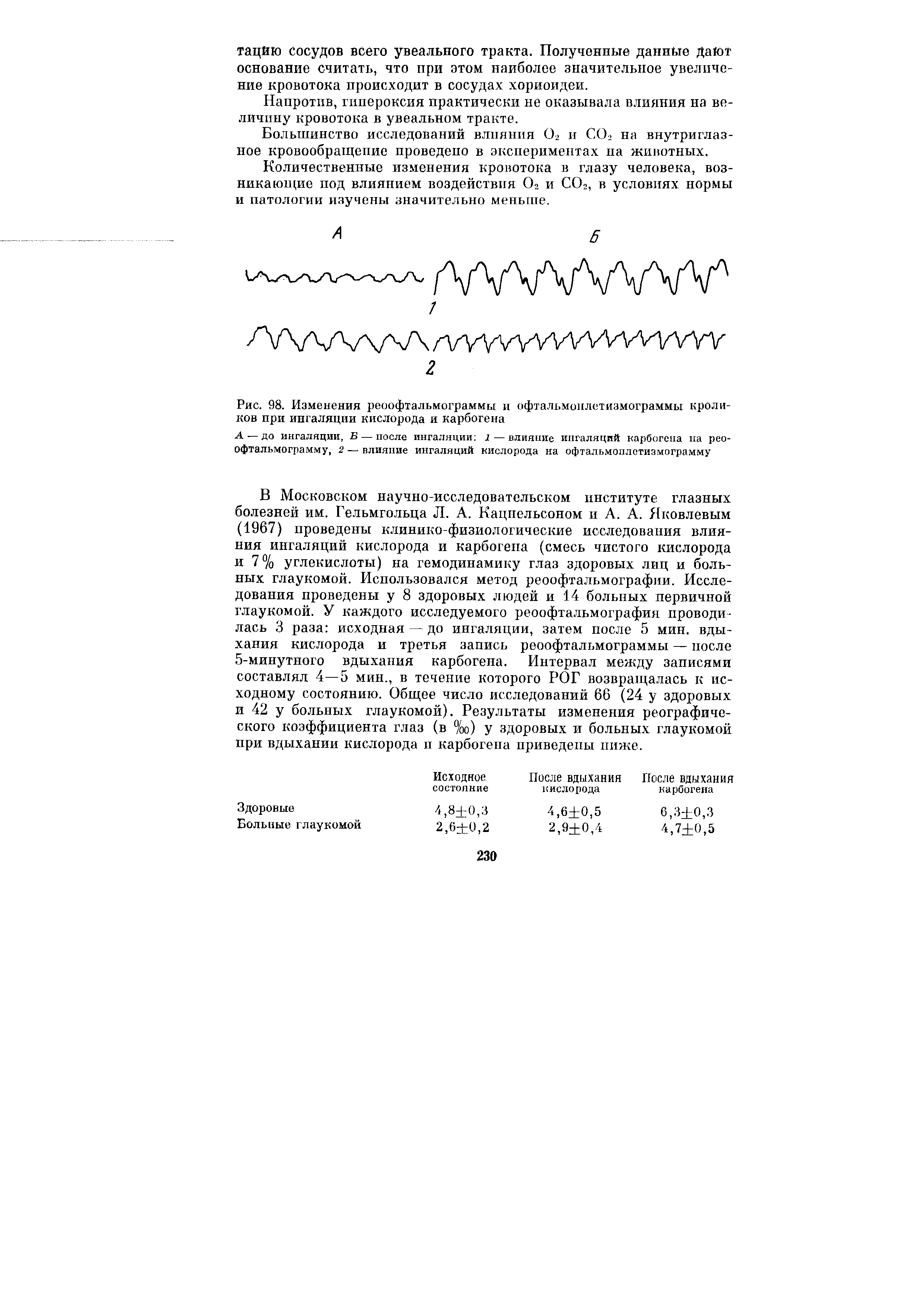 Рис. 98. Изменения реоофтальмограммы и офтальмонлетиамограммы кроликов при ингаляции кислорода и карбогена...