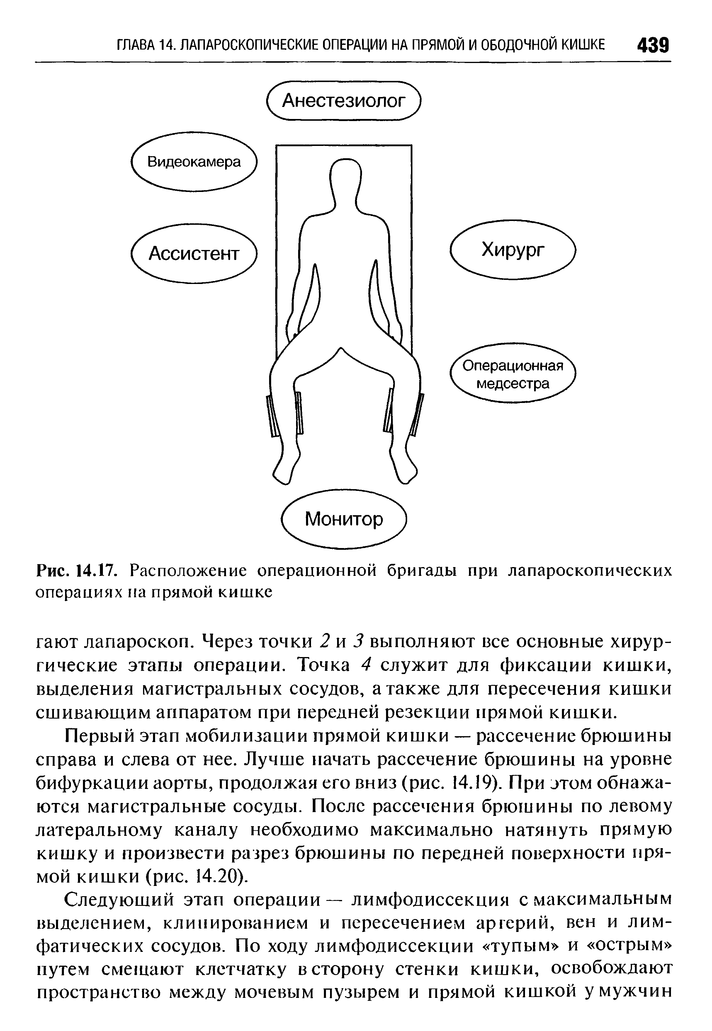 Рис. 14.17. Расположение операционной бригады при лапароскопических операциях па прямой кишке...