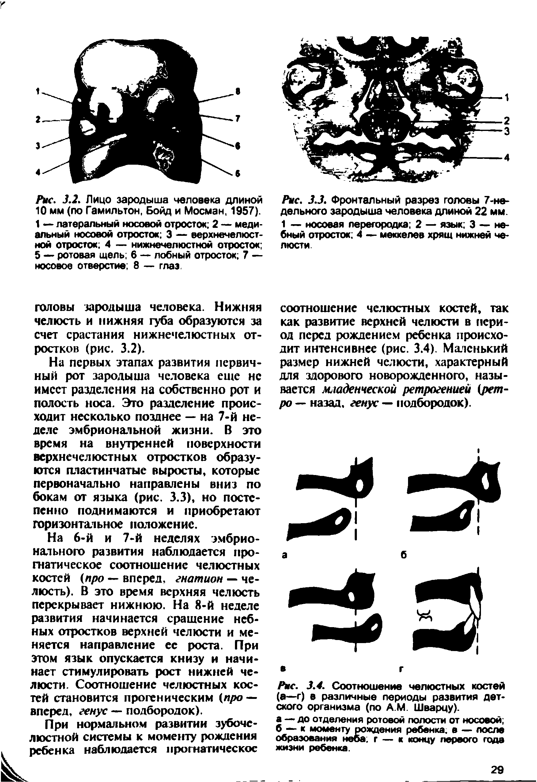 Рис. 3.3. Фронтальный разрез головы 7-не-дельного зародыша человека длиной 22 мм. 1 — носовая перегородка 2 — язык 3 — небный отросток 4 — меккелев хрящ нижней челюсти...