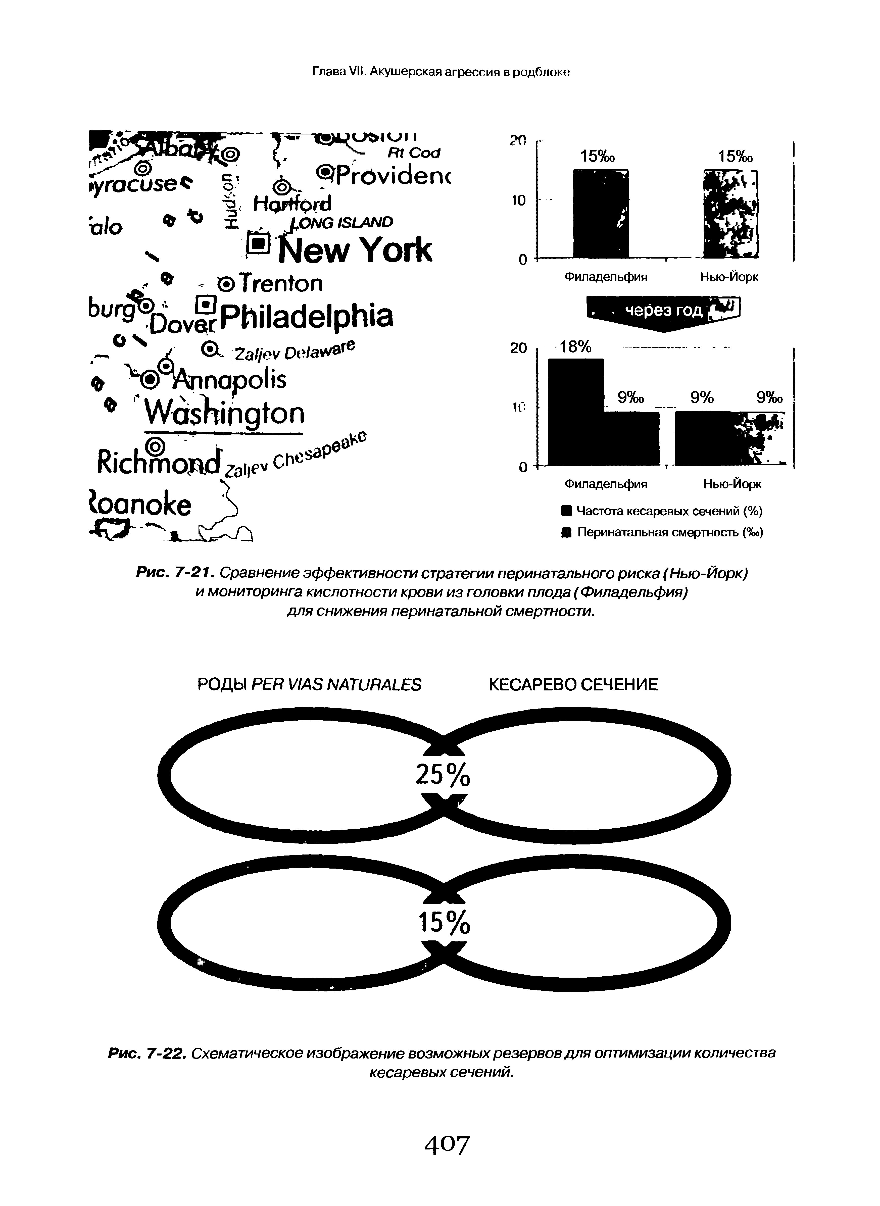 Рис. 7-21. Сравнение эффективности стратегии перинатального риска (Нью-Йорк) и мониторинга кислотности крови из головки плода (Филадельфия) для снижения перинатальной смертности.