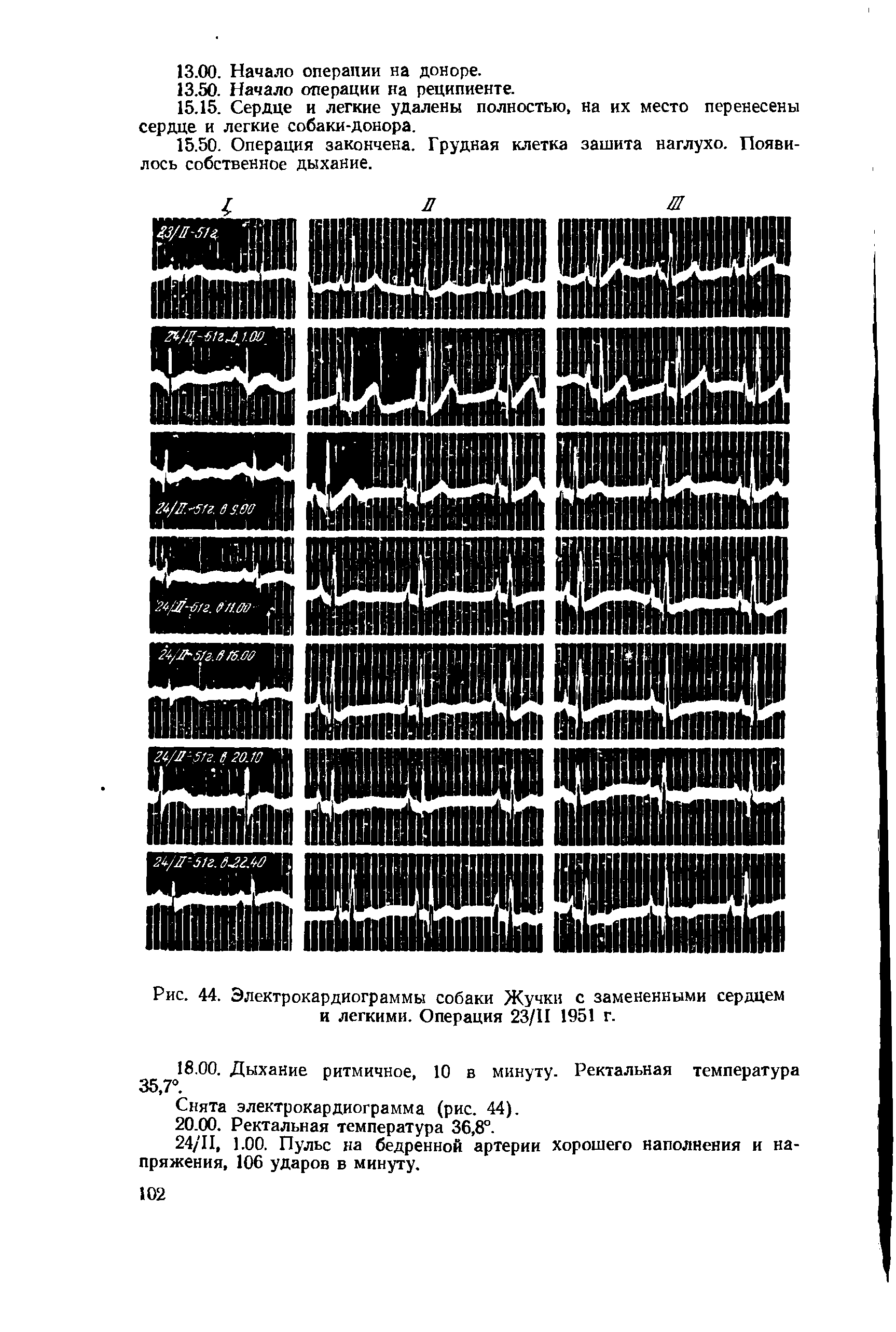 Рис. 44. Электрокардиограммы собаки Жучки с замененными сердцем и легкими. Операция 23/П 1951 г.
