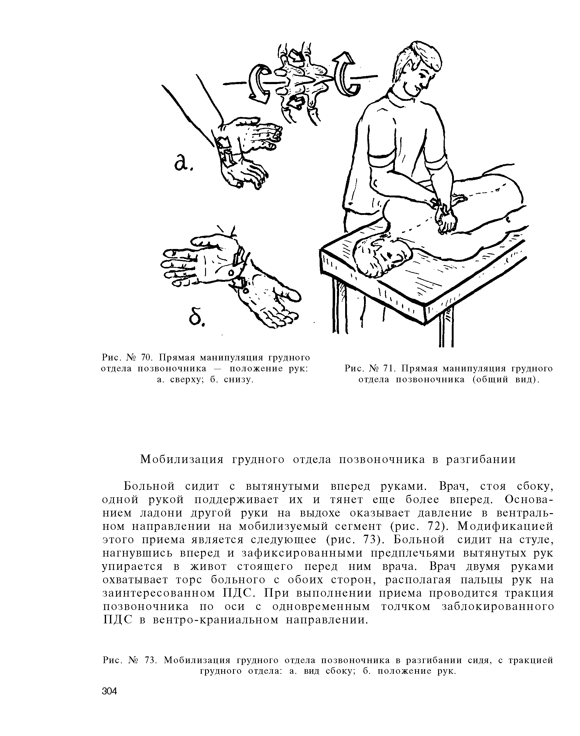 Рис. № 73. Мобилизация грудного отдела позвоночника в разгибании сидя, с тракцией грудного отдела а. вид сбоку б. положение рук.