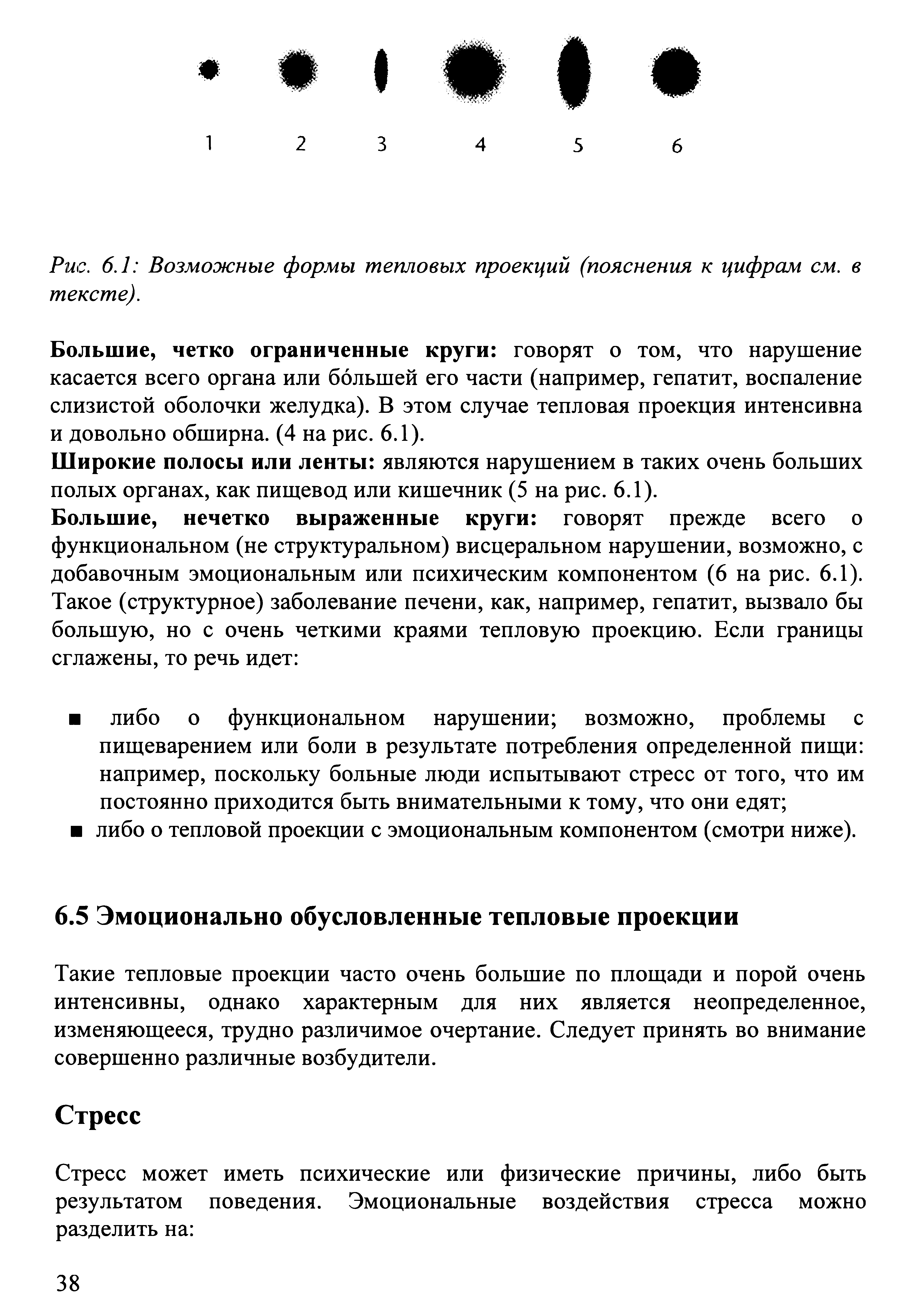 Рис. 6.1 Возможные формы тепловых проекций (пояснения к цифрам см. в тексте).