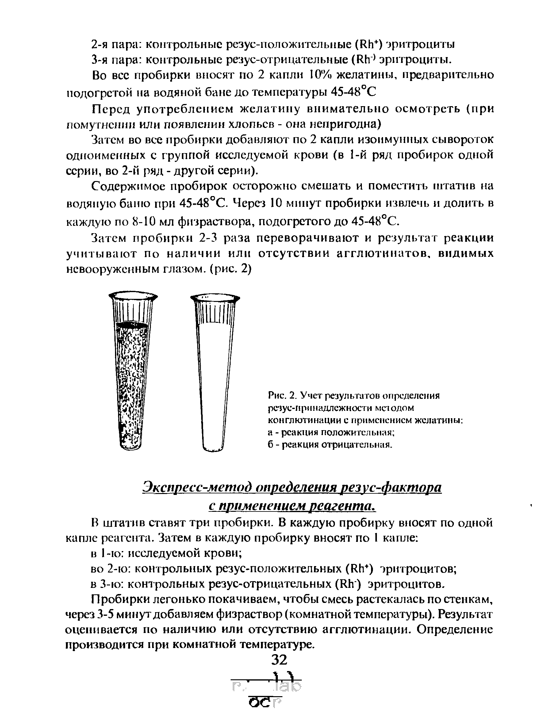 Рис. 2. Учет результатов определения рсзус-принадлсжности методом конглютинации с применением желатины а - реакция положительная ...