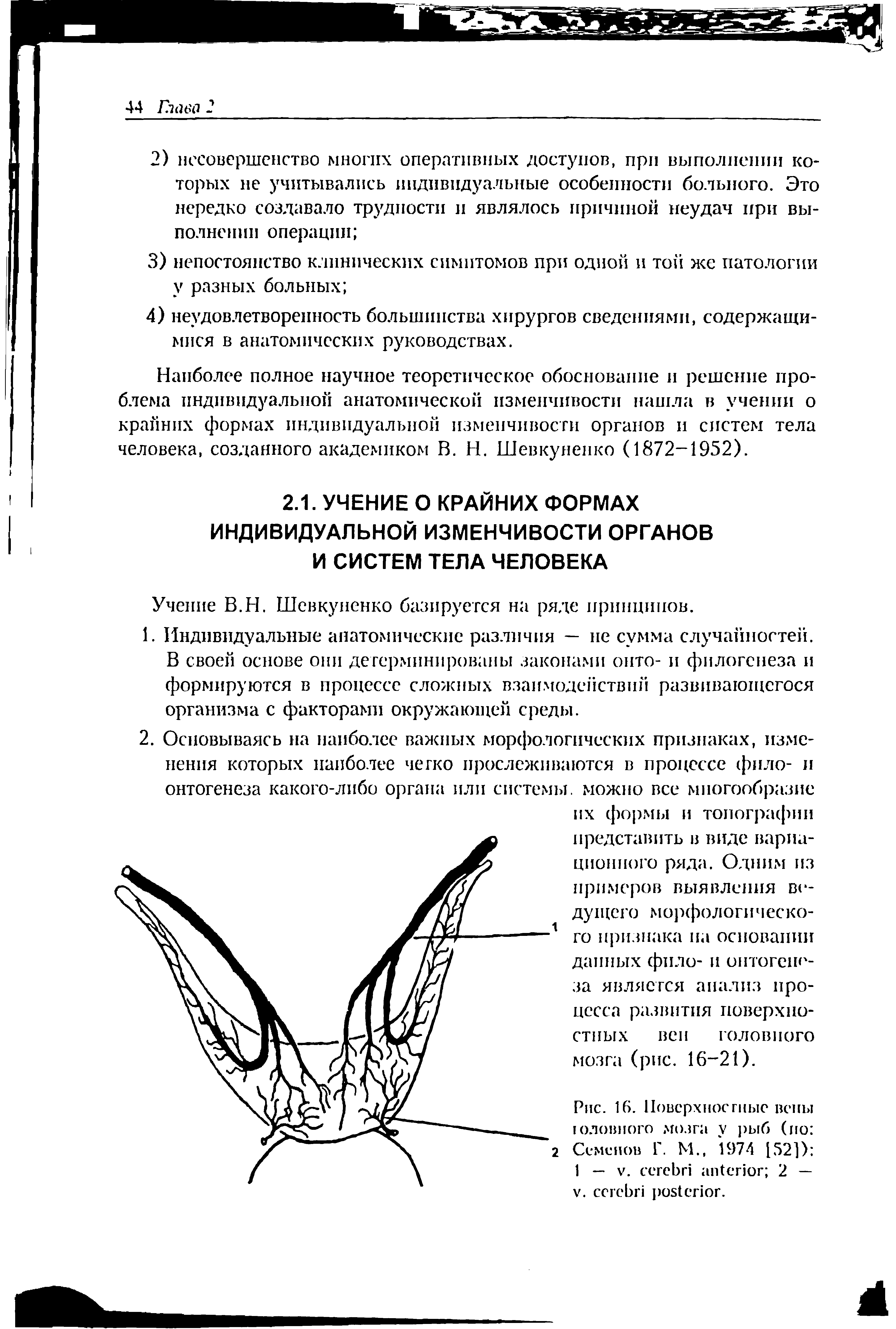 Рис. 16. Повсрхносгныс вены головного мозга у рыб (но Семенов Г. М., 1974 152]) 1 — V. 2 — . .