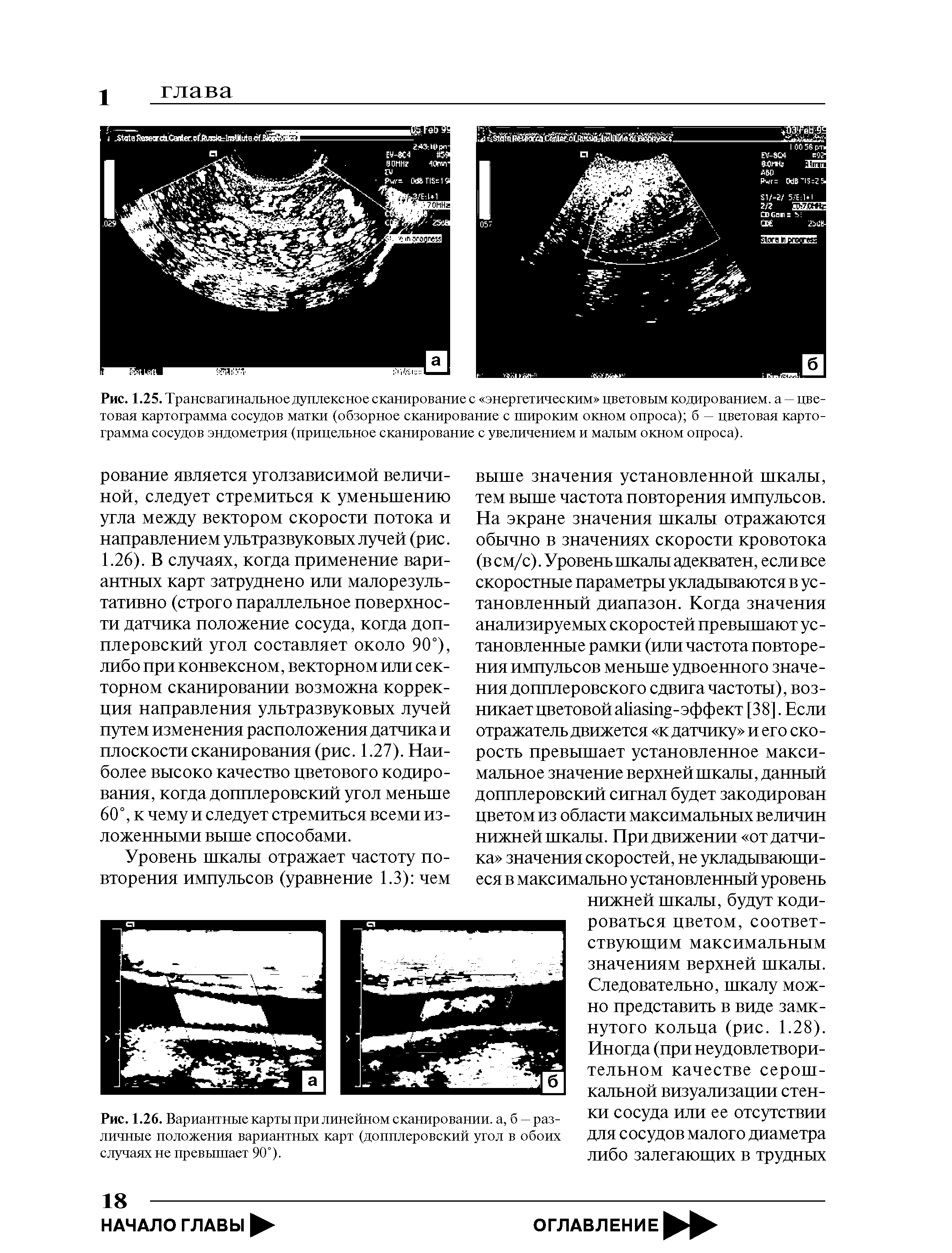 Рис. 1.25. Трансвагинальное дуплексное сканирование с энергетическим цветовым кодированием, а — цветовая картограмма сосудов матки (обзорное сканирование с широким окном опроса) б — цветовая картограмма сосудов эндометрия (прицельное сканирование с увеличением и малым окном опроса).