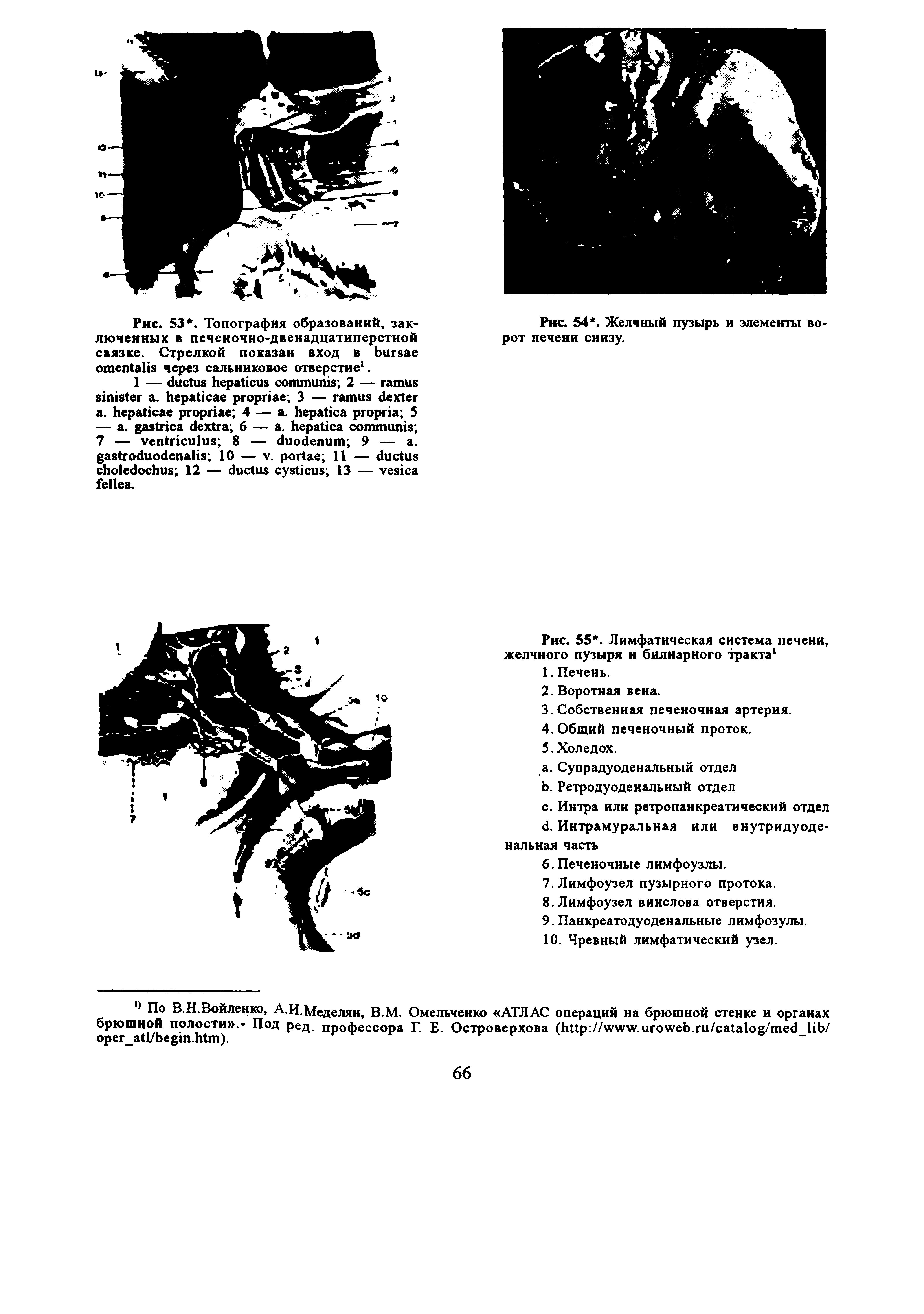 Рис. 55. Лимфатическая система печени, желчного пузыря и билиарного тракта1...