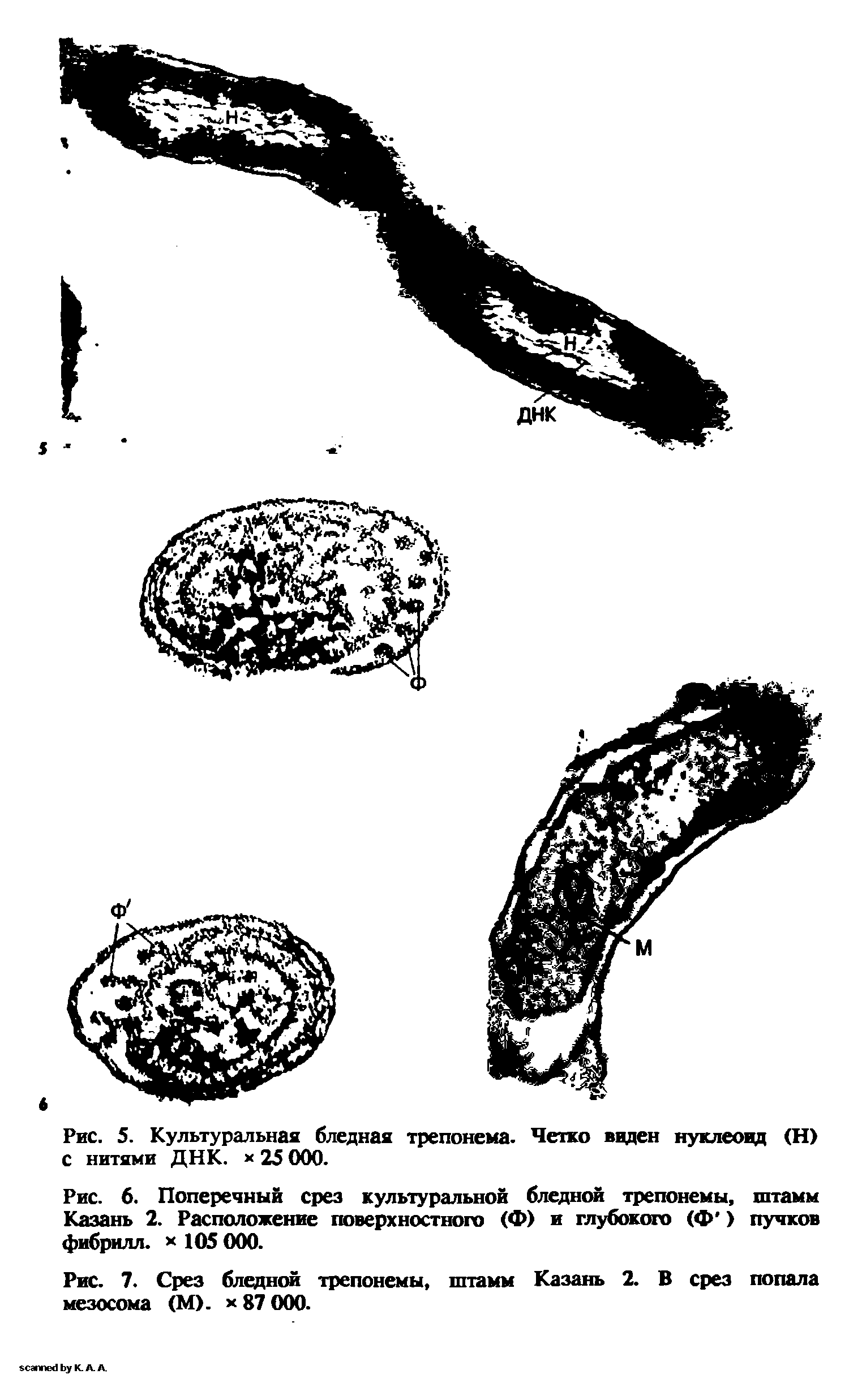 Рис. 7. Срез бледной трепонемы, штамм Казань 2. В срез попала мезосома (М). х 87 000.