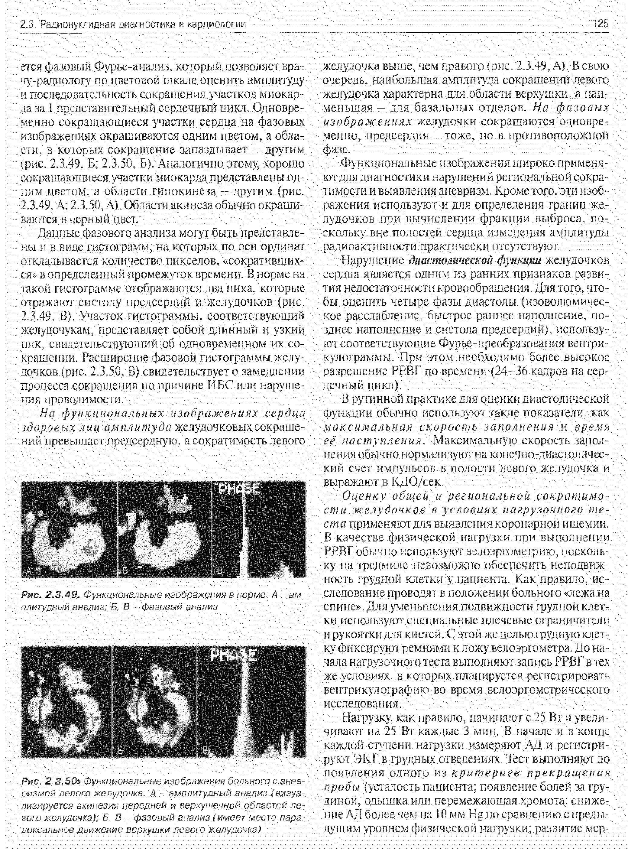 Рис. 2.3.49. Функциональные изображения в норме А - ам плитудный анализ Б, В - фазовый анализ г Г...