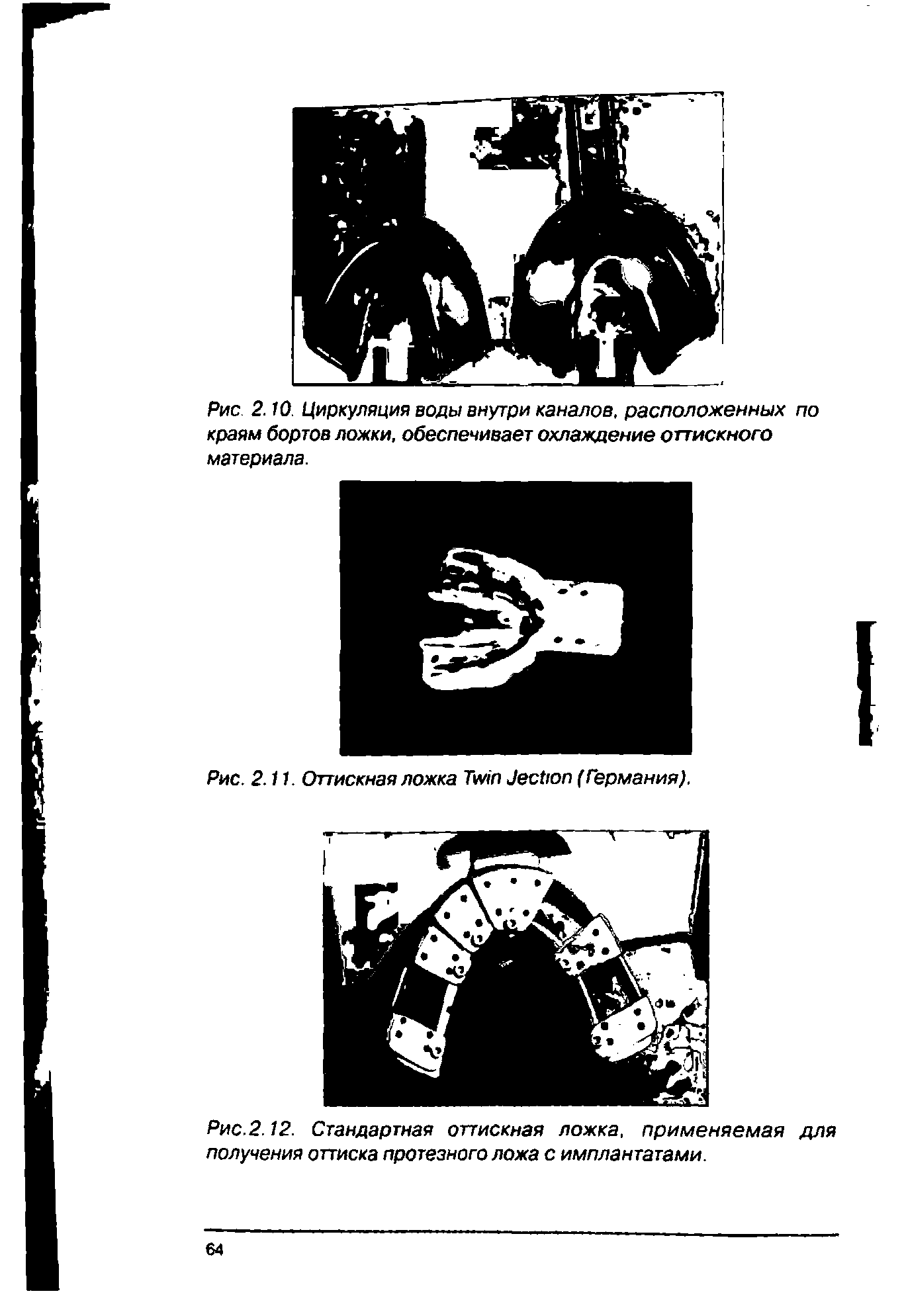 Рис.2.12. Стандартная оттискная ложка, применяемая для получения оттиска протезного ложа с имплантатами.