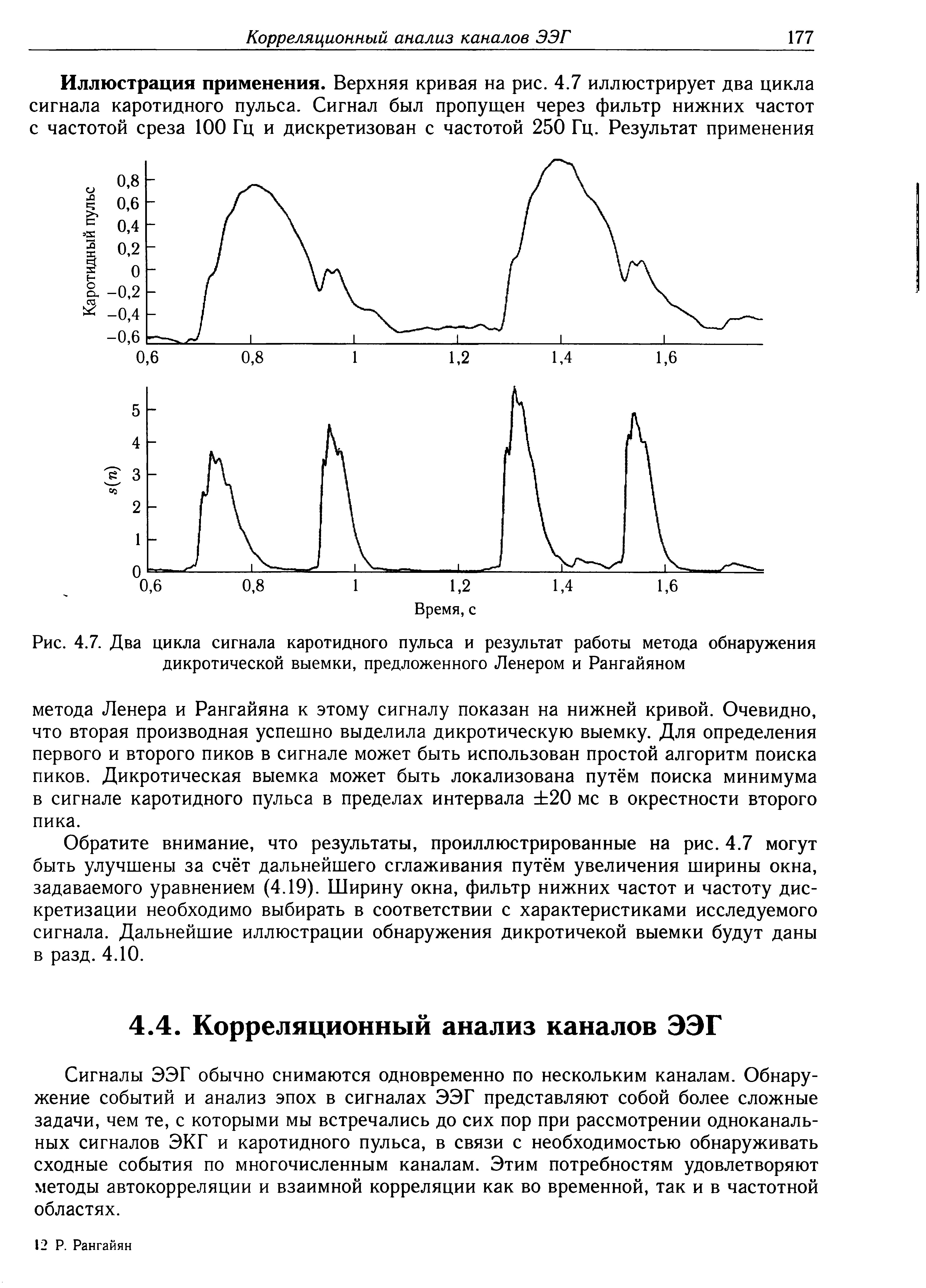 Рис. 4.7. Два цикла сигнала каротидного пульса и результат работы метода обнаружения дикротической выемки, предложенного Ленером и Рангайяном...