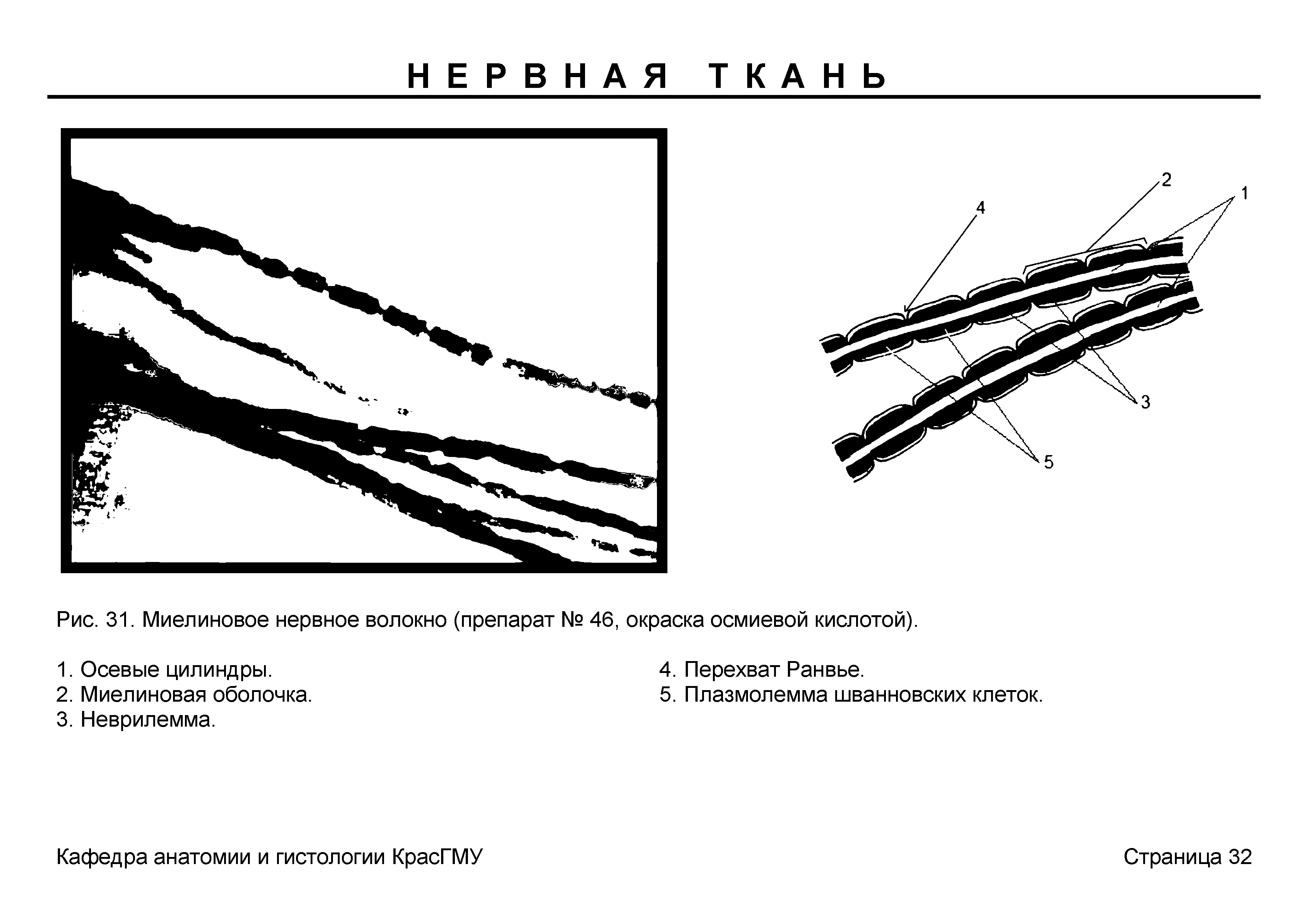 Рис. 31. Миелиновое нервное волокно (препарат № 46, окраска осмиевой кислотой).