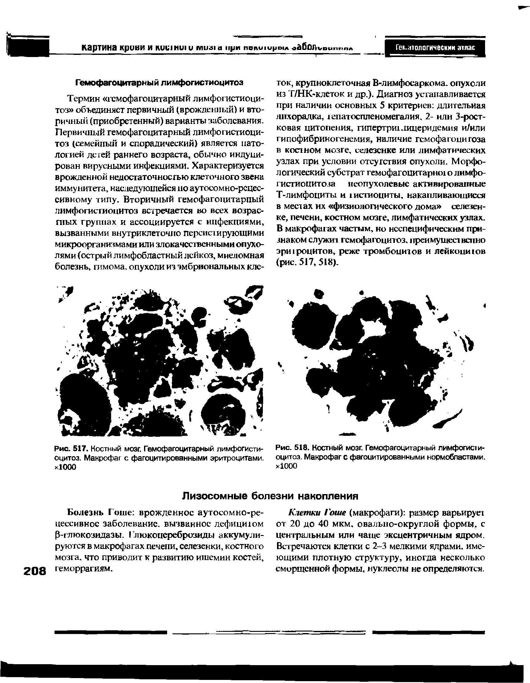 Рис. 517. Костный мозг. Гемофагоцитарный лимфогистиоцитоз. Макрофаг с фагоцитированными эритроцитами. Х1000...