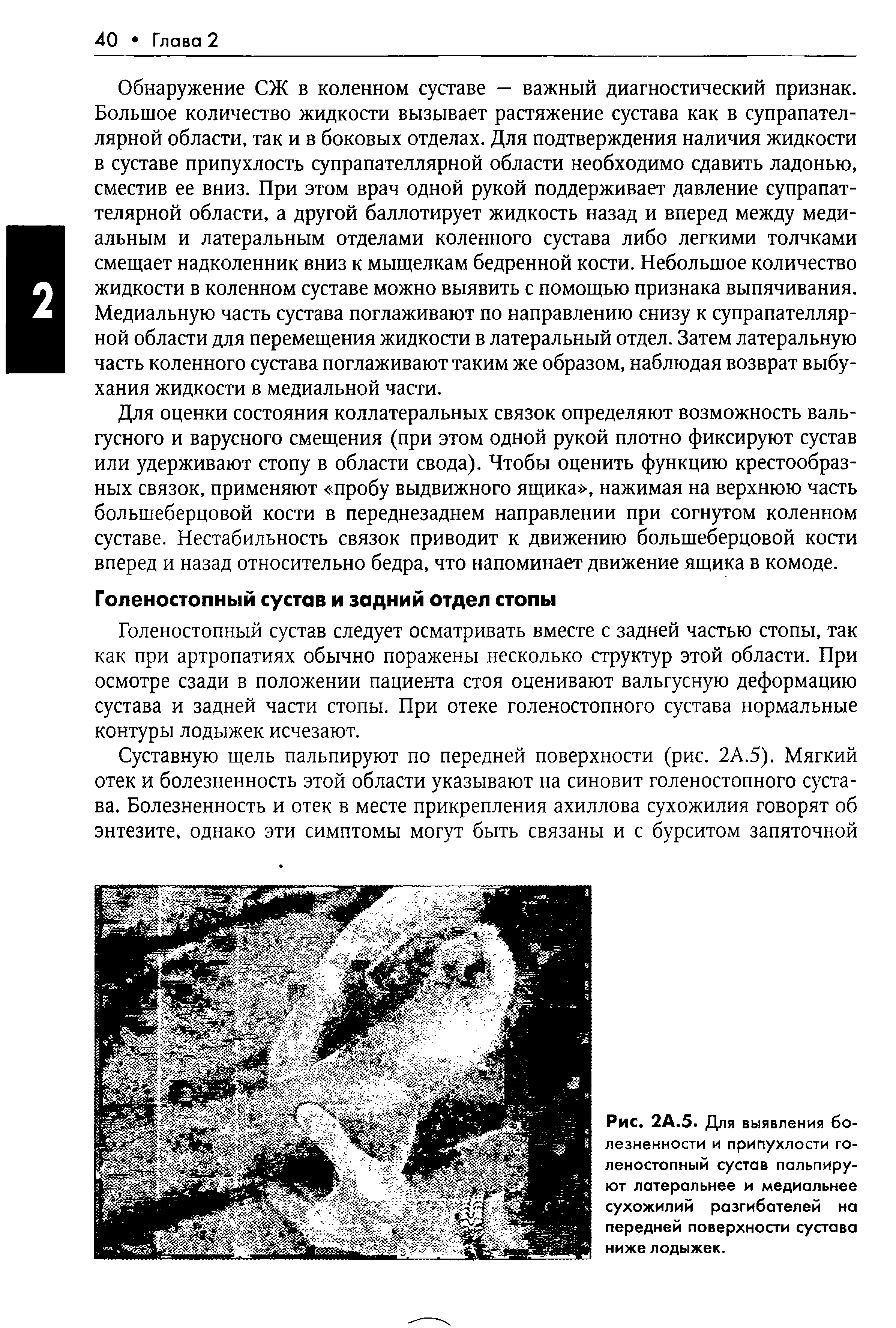 Рис. 2А.5. Для выявления болезненности и припухлости голеностопный сустав пальпируют латеральнее и медиальнее сухожилий разгибателей на передней поверхности сустава ниже лодыжек.