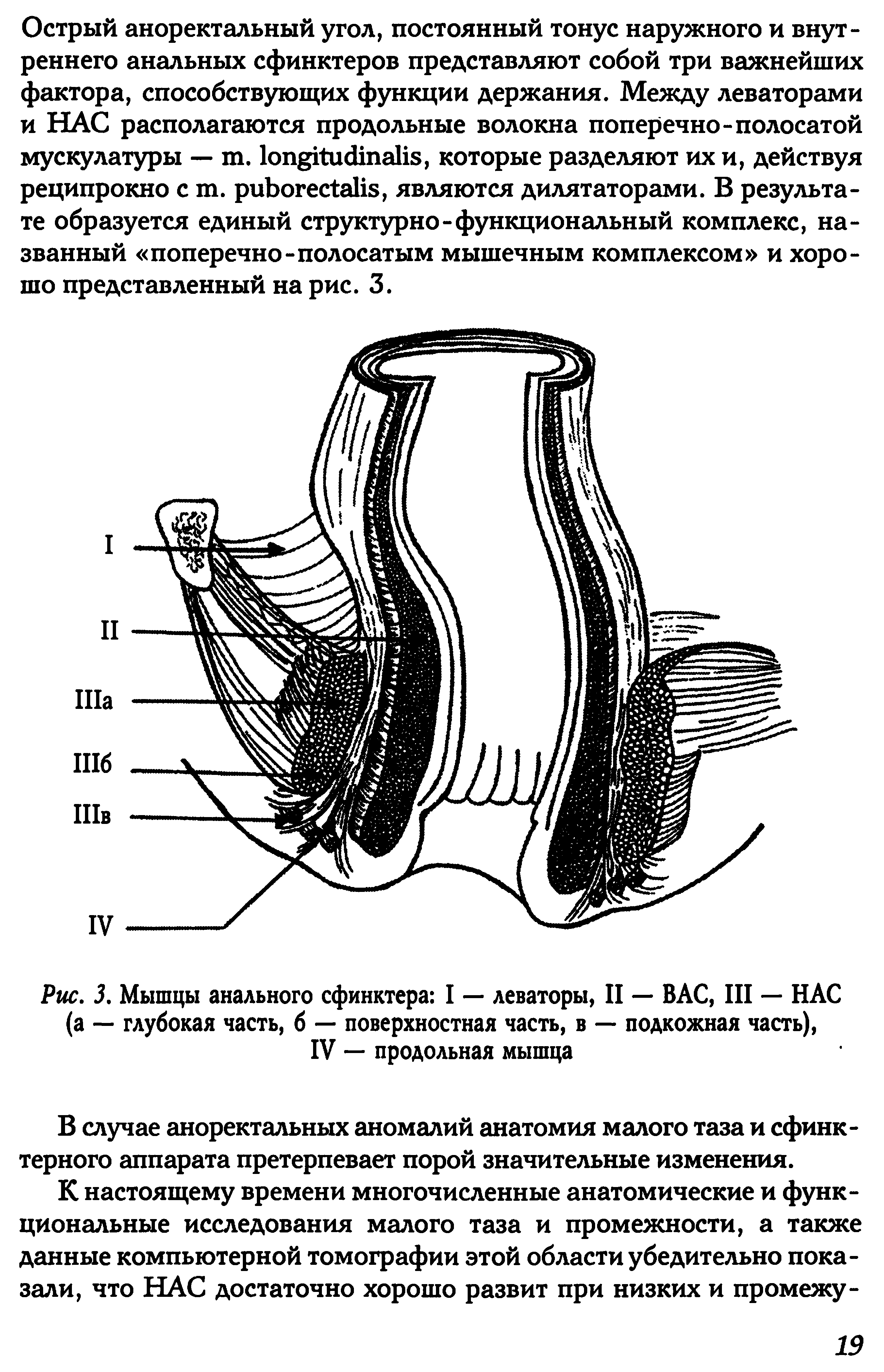 Рис. 3. Мышцы анального сфинктера I — леваторы, II — ВАС, III — НАС (а — глубокая часть, б — поверхностная часть, в — подкожная часть), IV — продольная мышца...