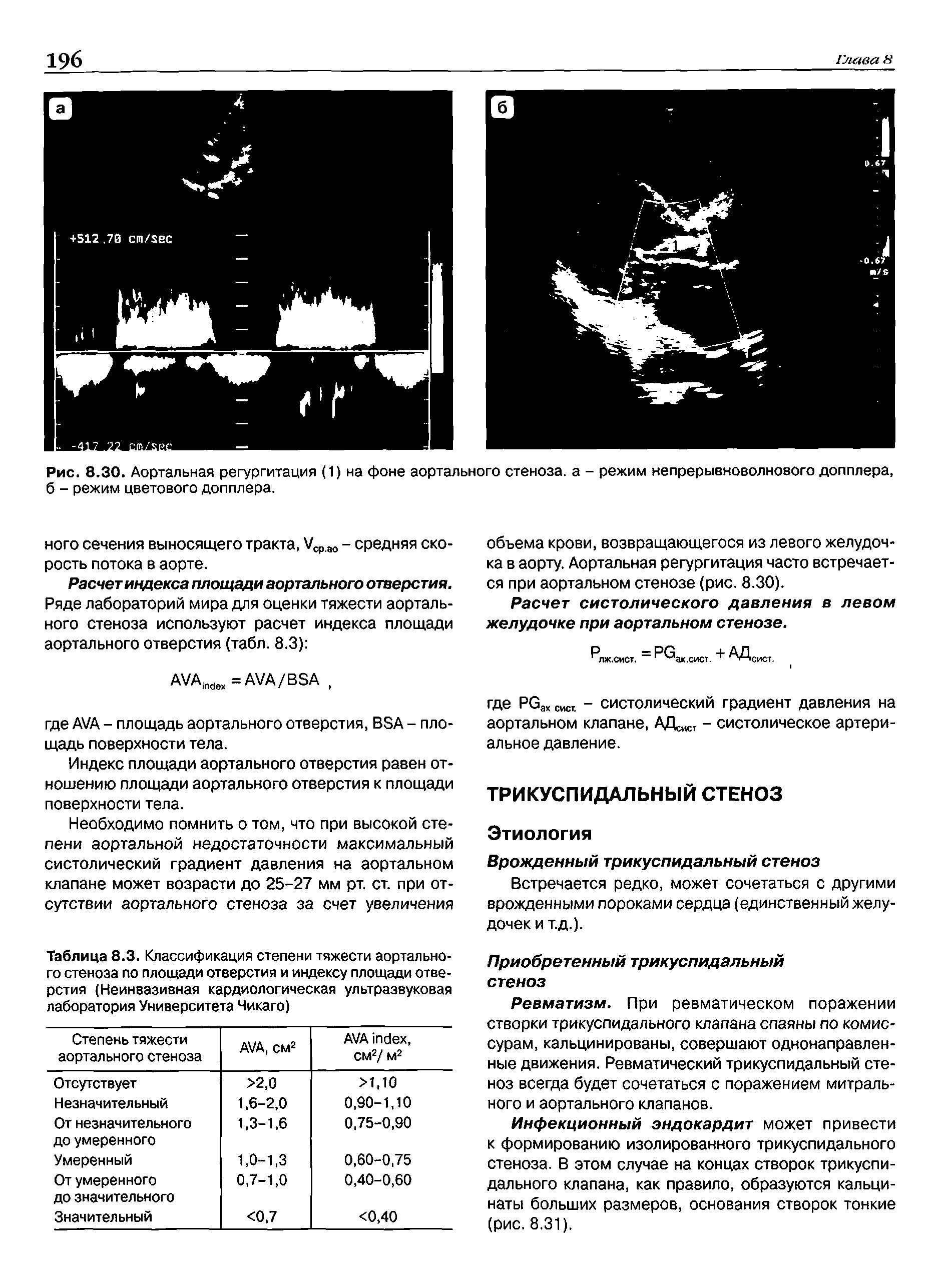 Рис. 8.30. Аортальная регургитация (1) на фоне аортального стеноза, а - режим непрерывноволнового допплера, б - режим цветового допплера.