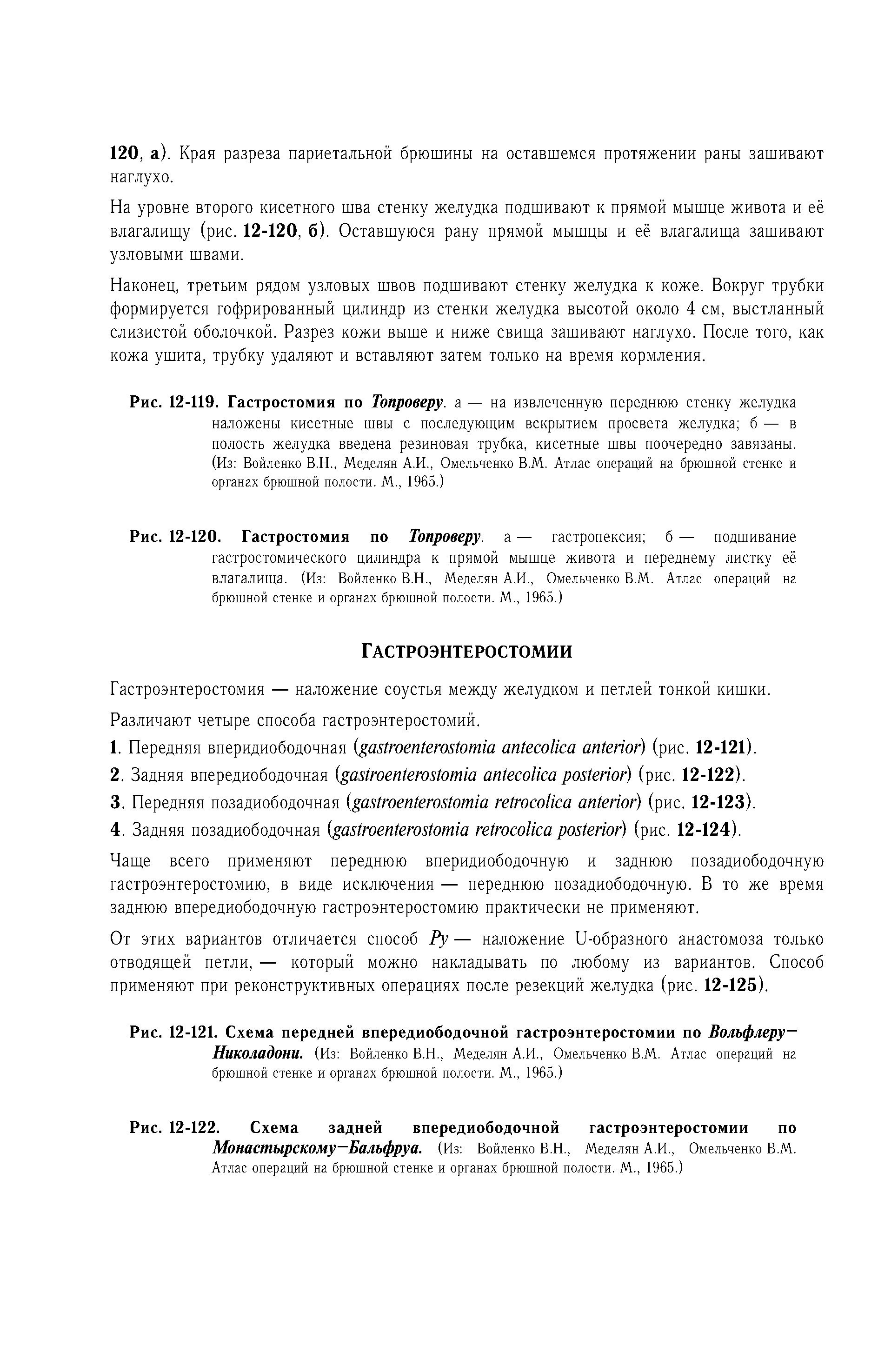 Рис. 12-119. Гастростомия по Топроверу. а — на извлеченную переднюю стенку желудка наложены кисетные швы с последующим вскрытием просвета желудка б — в полость желудка введена резиновая трубка, кисетные швы поочередно завязаны. (Из Войленко В.Н., Меделян А.И., Омельченко В.М. Атлас операций на брюшной стенке и органах брюшной полости. М., 1965.)...