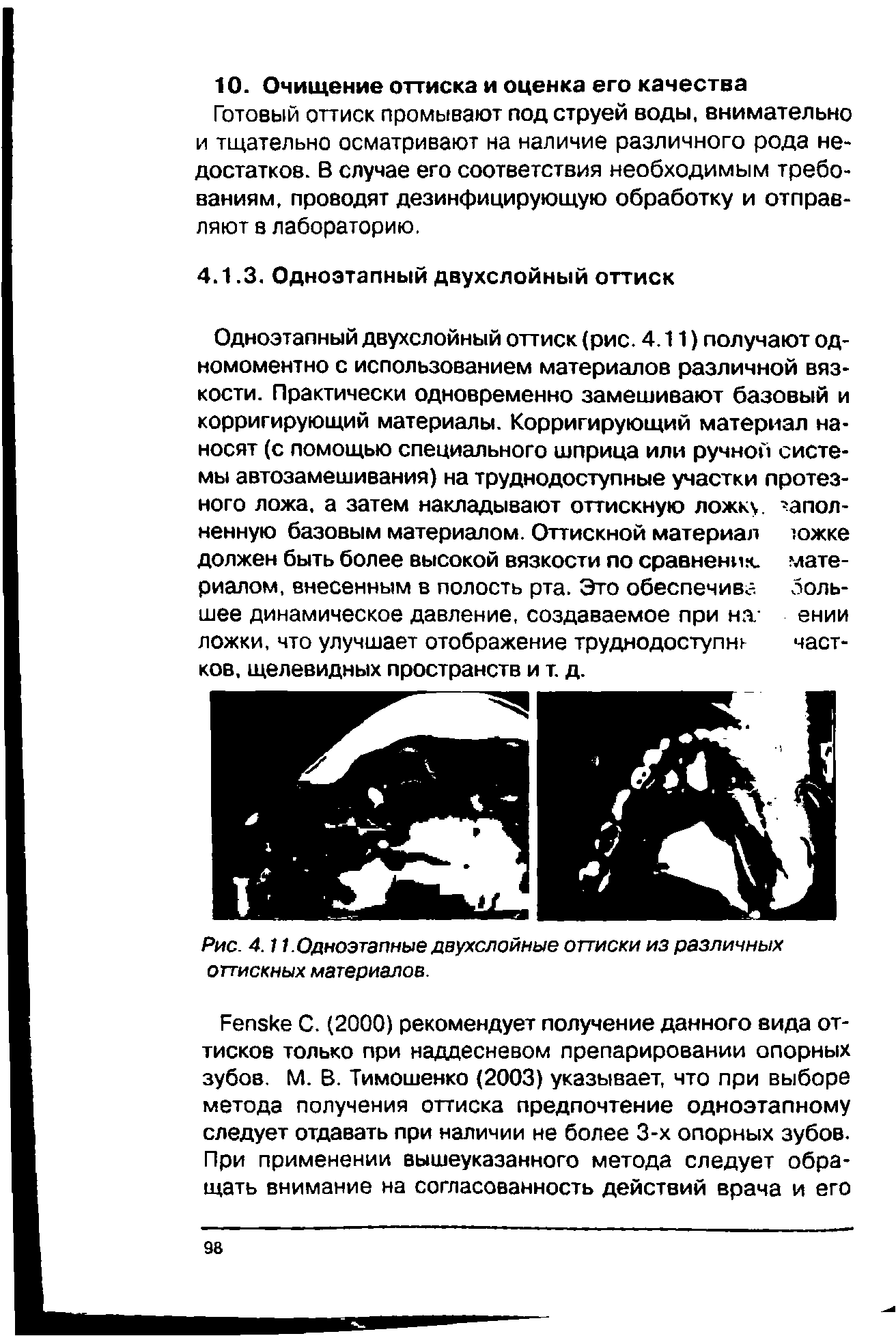 Рис. 4.11. Одноэтапные двухслойные оттиски из различных оттискных материалов.