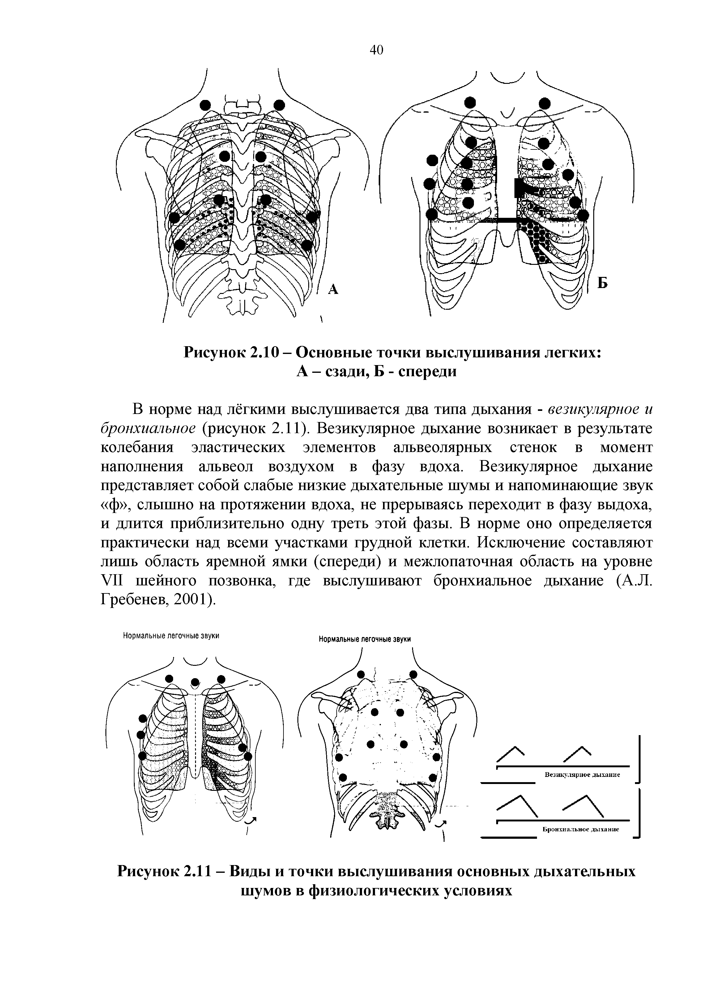 Схемы дыхательных шумов