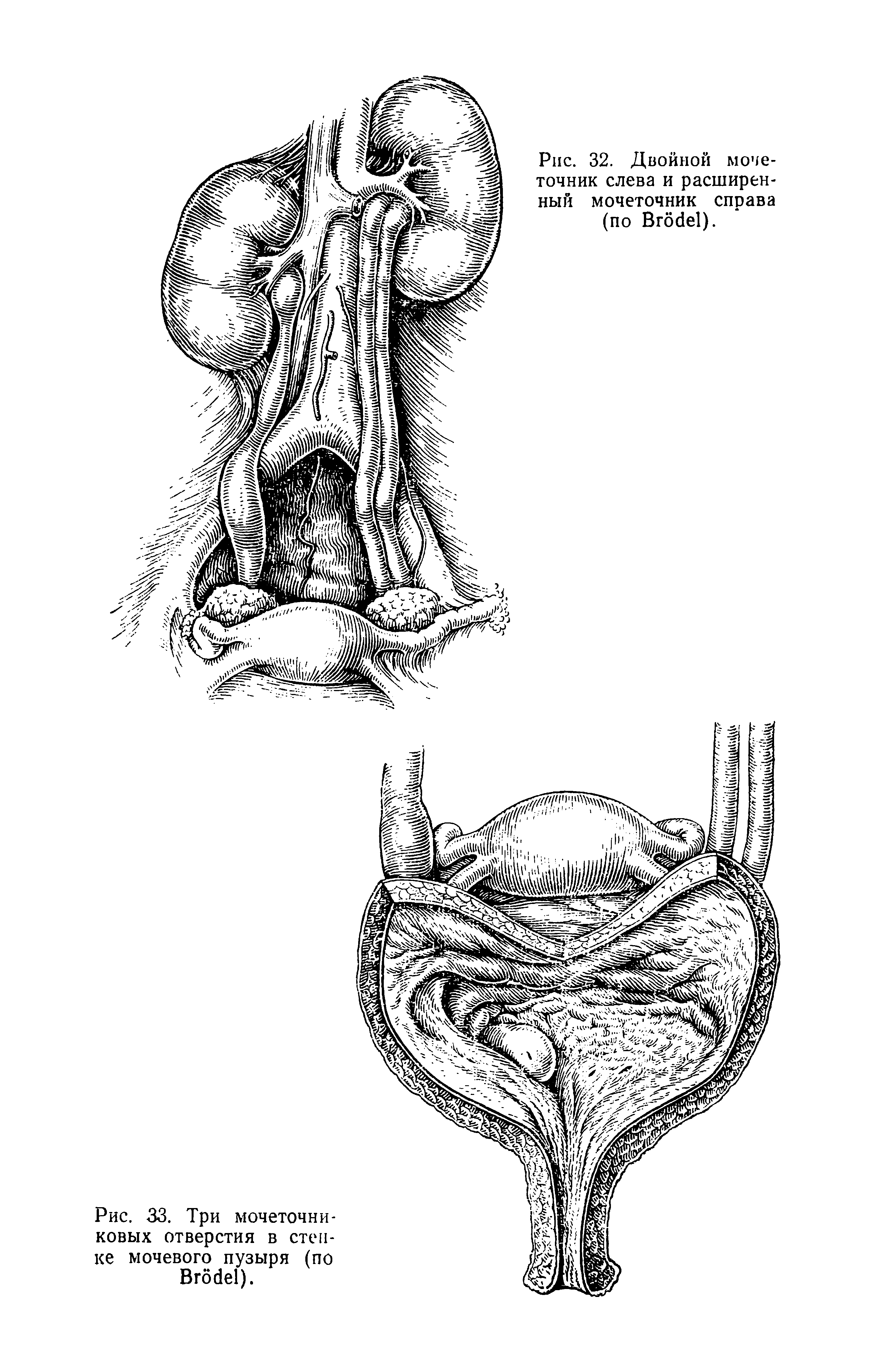 Рис. 33. Три мочеточниковых отверстия в стенке мочевого пузыря (по B ).