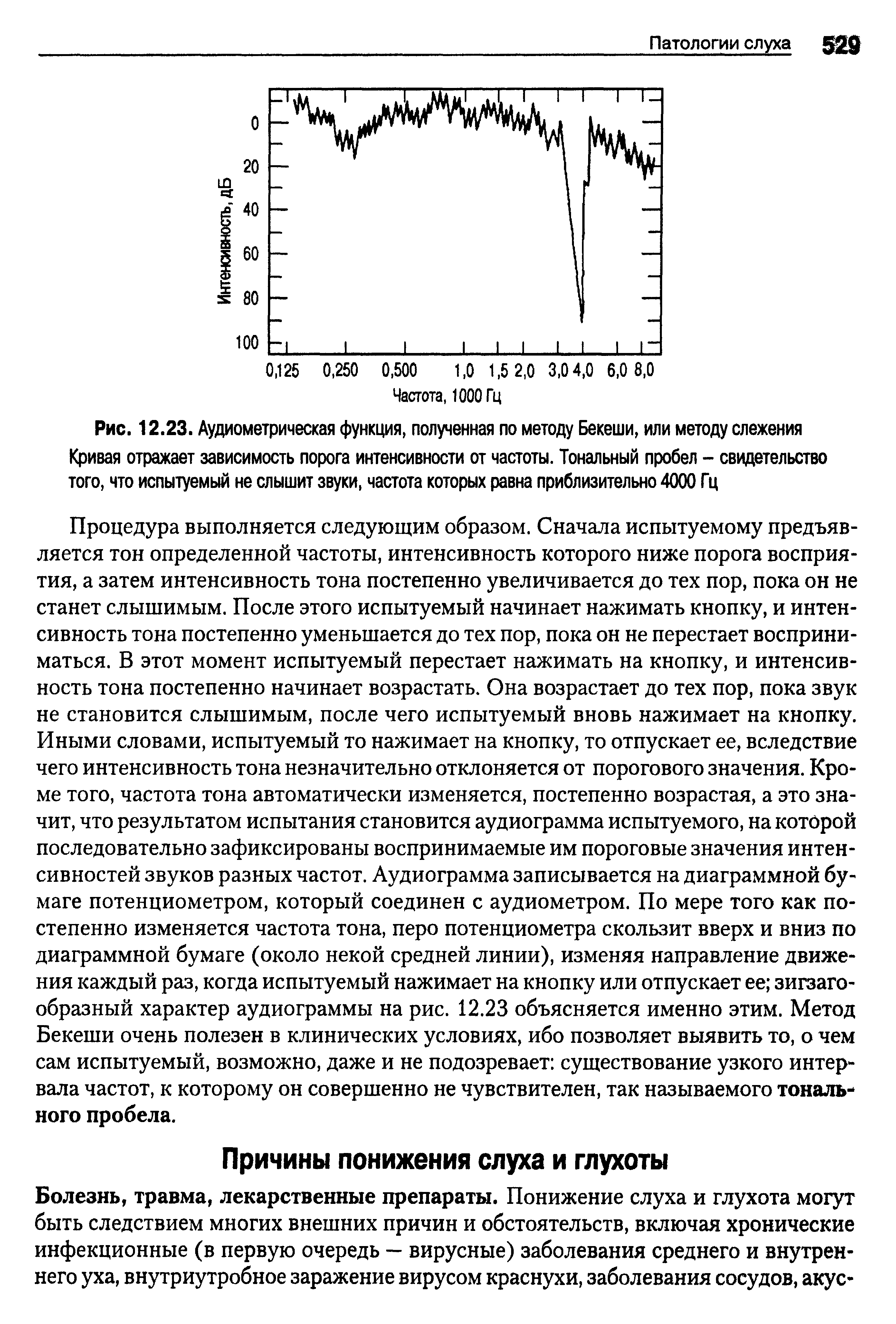 Рис. 12.23. Аудиометрическая функция, полученная по методу Бекеши, или методу слежения Кривая отражает зависимость порога интенсивности от частоты. Тональный пробел - свидетельство того, что испытуемый не слышит звуки, частота которых равна приблизительно 4000 Гц...
