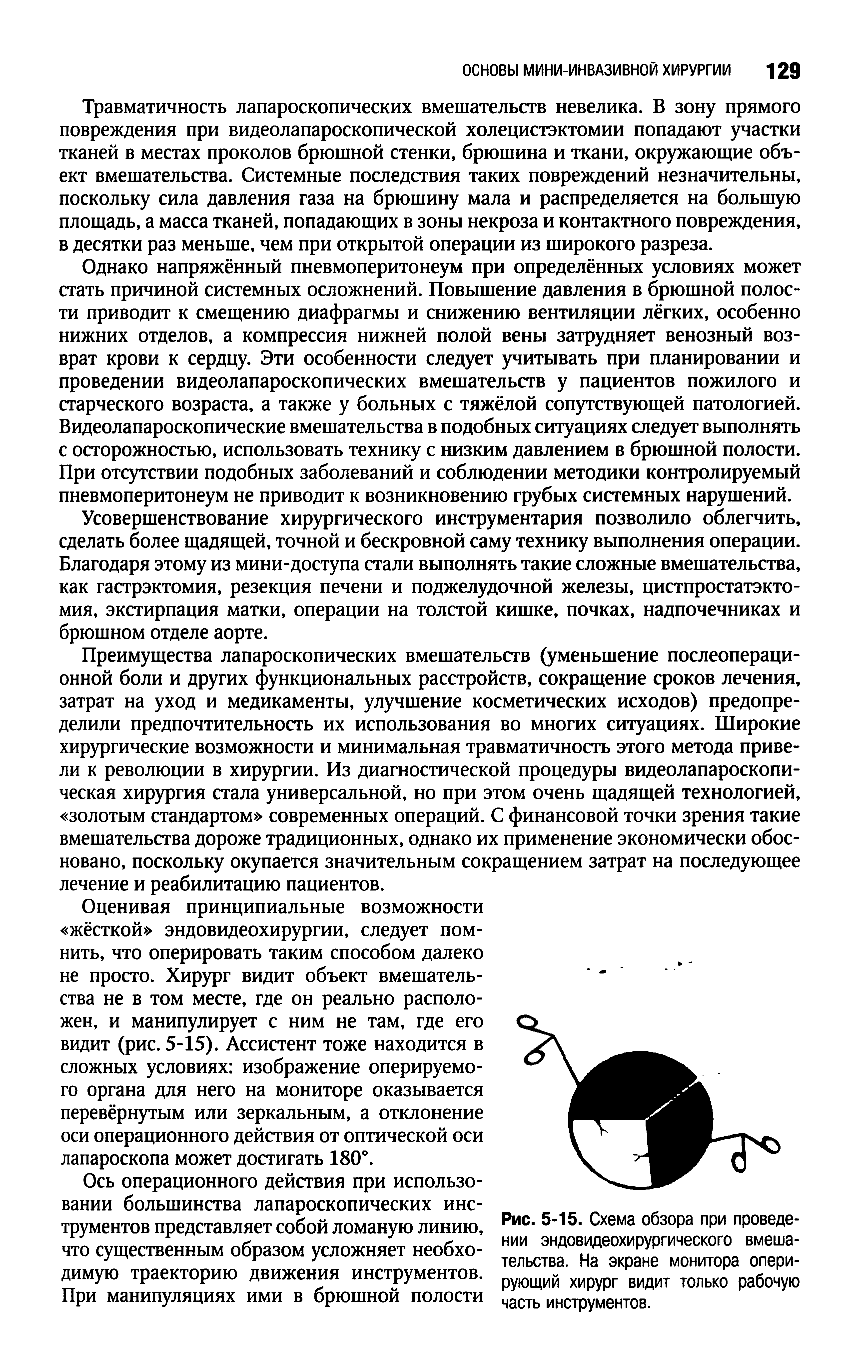 Рис. 5-15. Схема обзора при проведении эндовидеохирургического вмешательства. На экране монитора оперирующий хирург видит только рабочую часть инструментов.