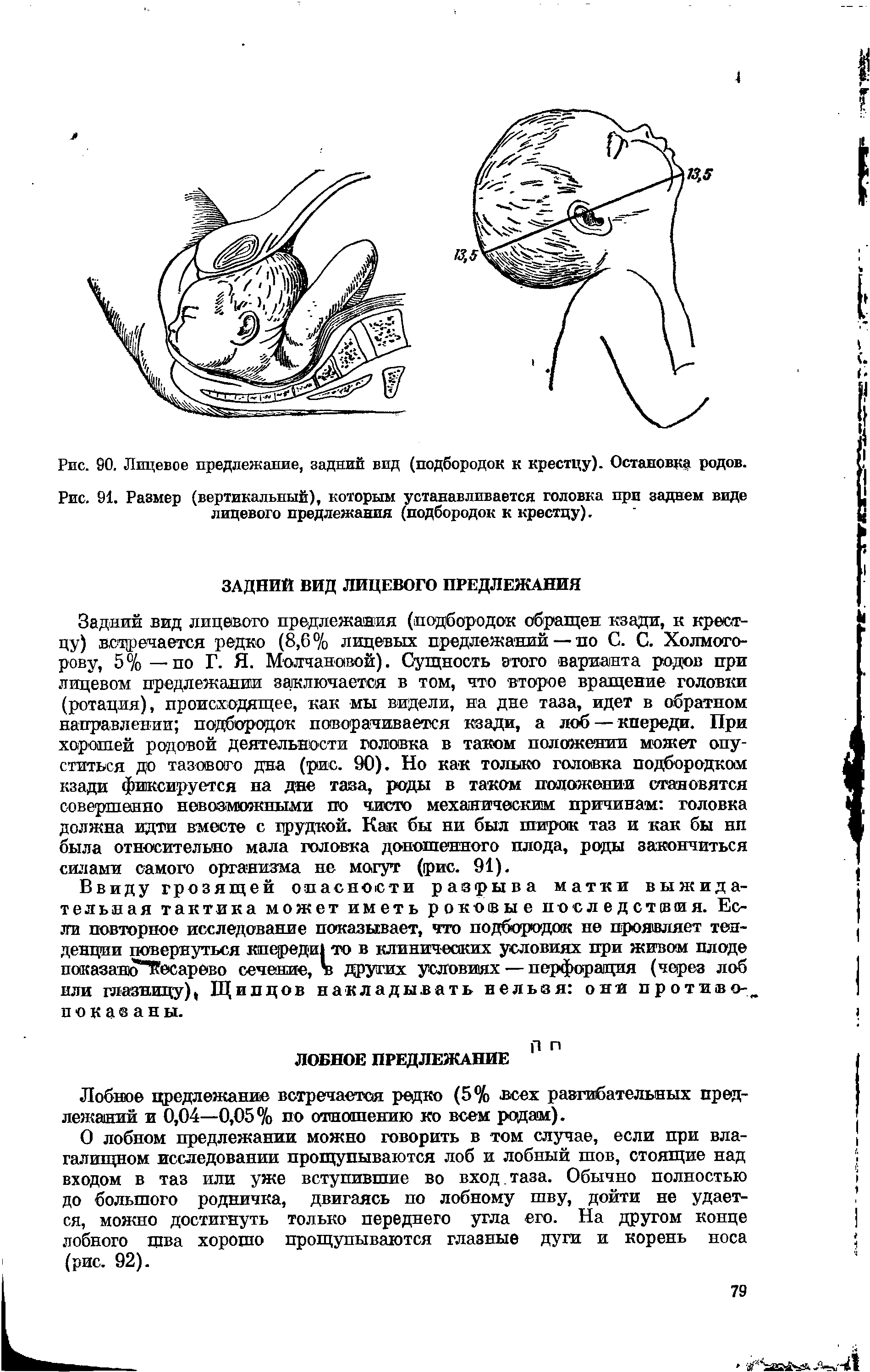 Рис. 91. Размер (вертикальный), которым устанавливается головка при заднем виде лицевого предлежания (подбородок к крестцу).