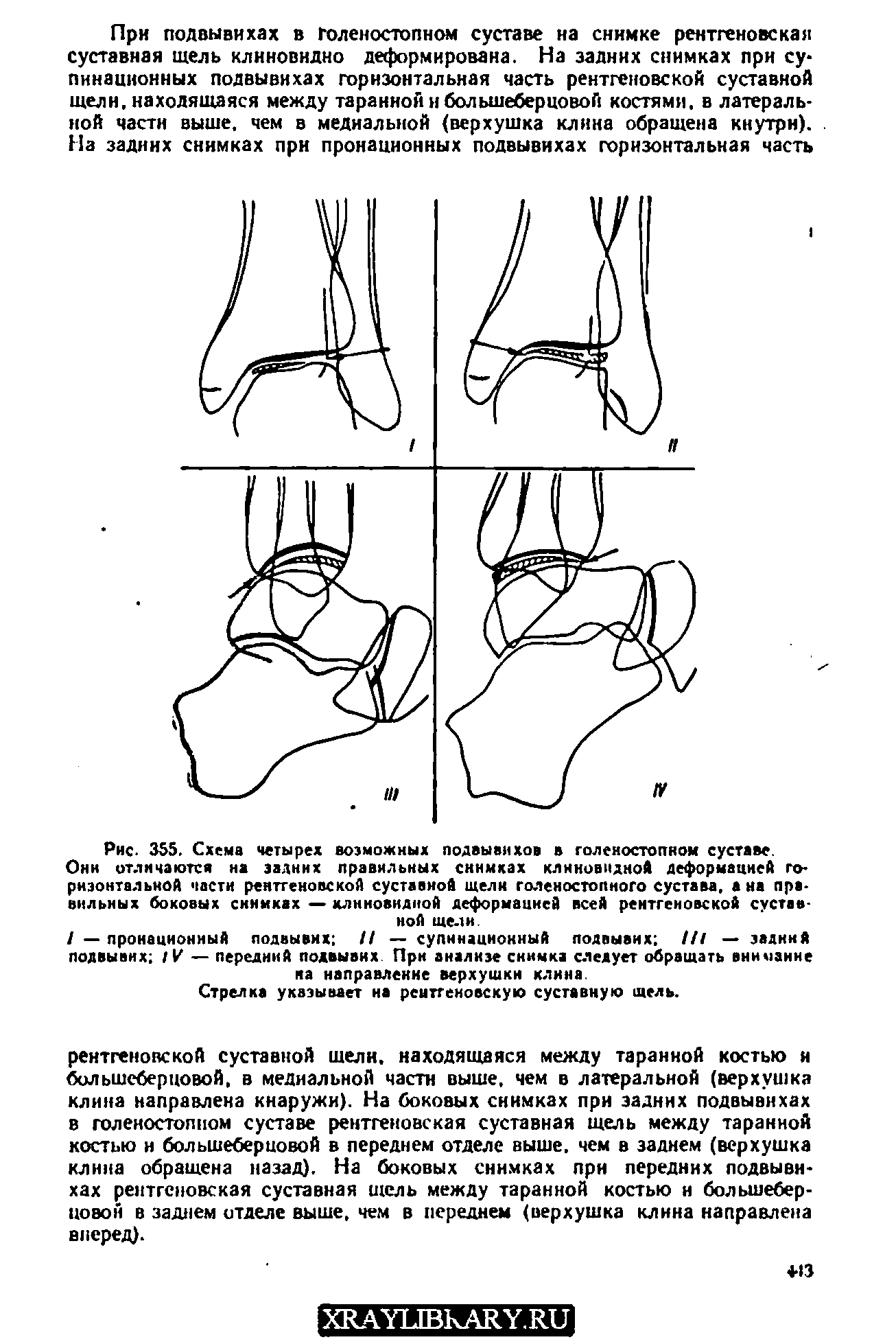 Описание голеностопного сустава