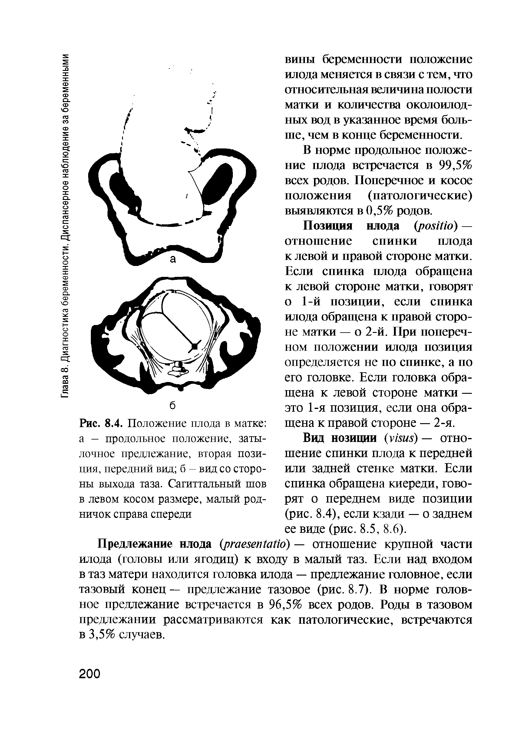 Рис. 8.4. Положение плода в матке а — продольное положение, затылочное предлежание, вторая позиция, передний вид б — вид со стороны выхода таза. Сагиттальный шов в левом косом размере, малый родничок справа спереди...