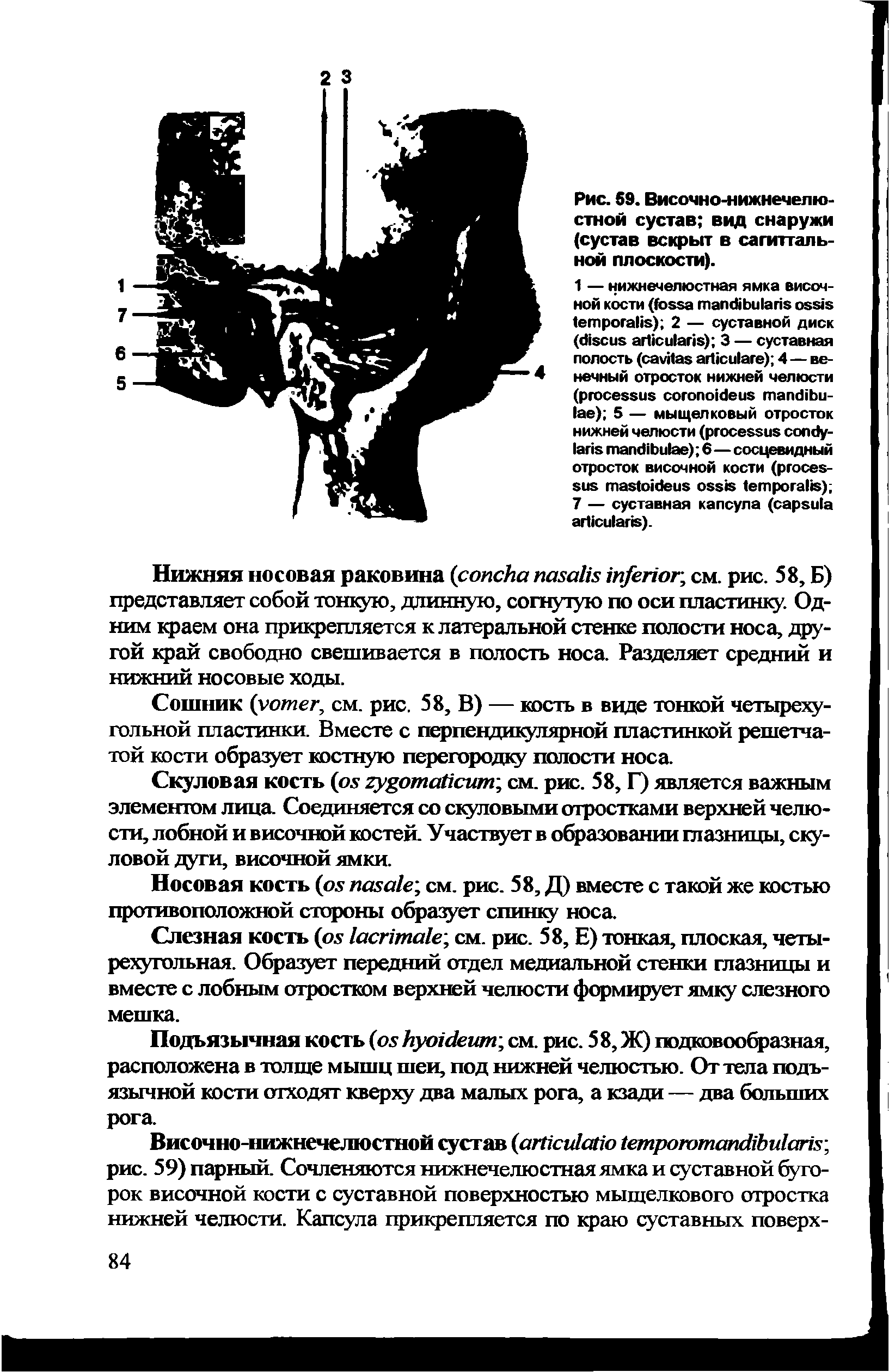 Рис. 59. Височно-нижнечелюстной сустав вид снаружи (сустав вскрыт в сагиттальной плоскости).