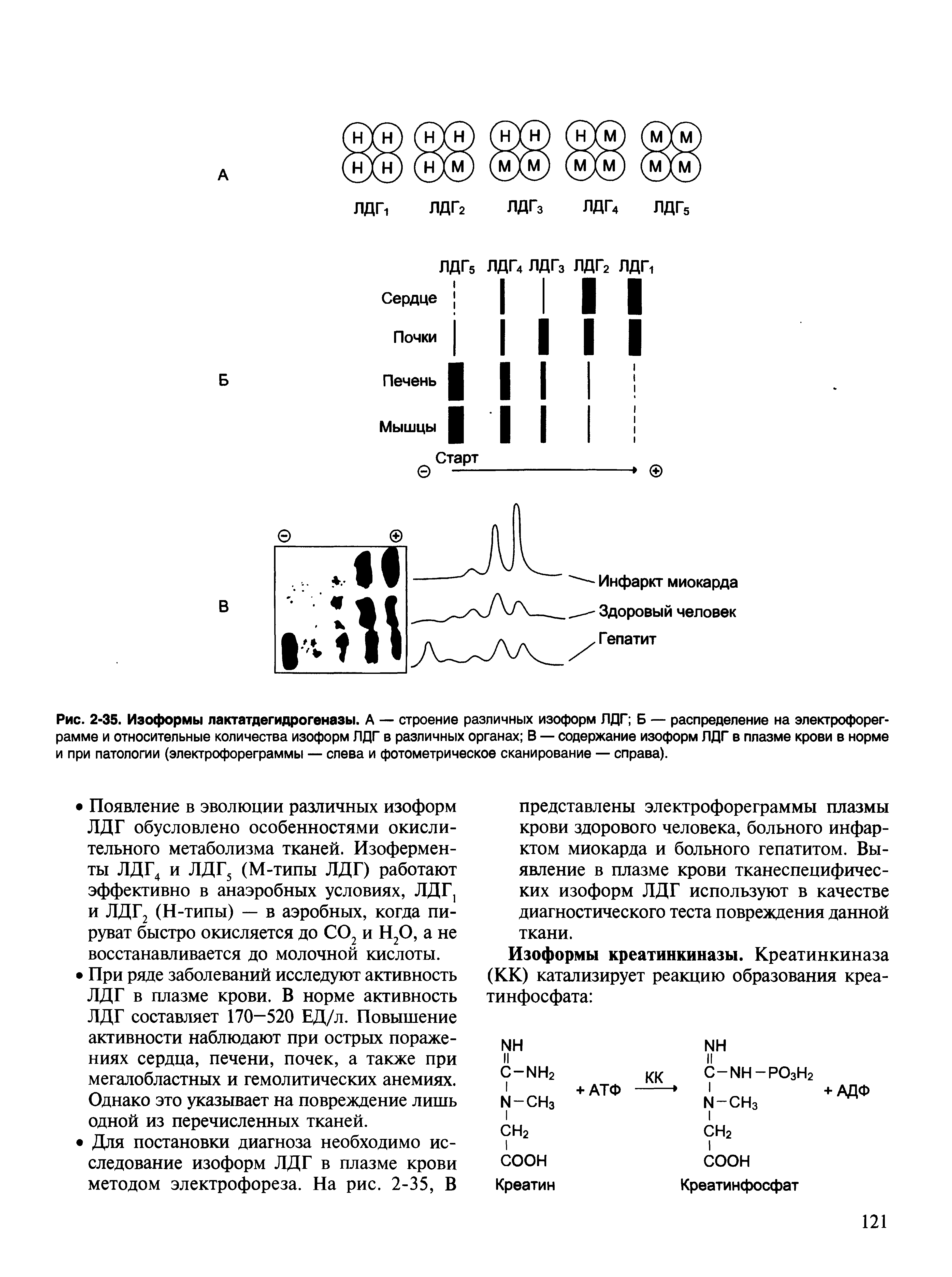 Рис. 2-35. Изоформы лактатдегидрогеназы. А — строение различных изоформ ЛДГ Б — распределение на электрофореграмме и относительные количества изоформ ЛДГ в различных органах В — содержание изоформ ЛДГ в плазме крови в норме и при патологии (электрофореграммы — слева и фотометрическое сканирование — справа).