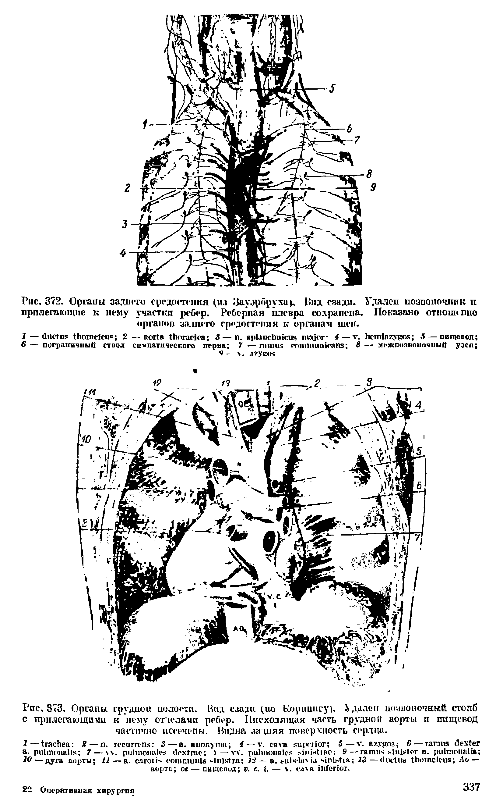 Рис. 373. Органы грудной полости. Вид сзади (ио Корииигу). Удален шг.шоночный столб с прилегающими к нему отделами ребер. Нисходящая часть грудной аорты и пищевод частично пссечспы. Видна задняя поверхность сердца.