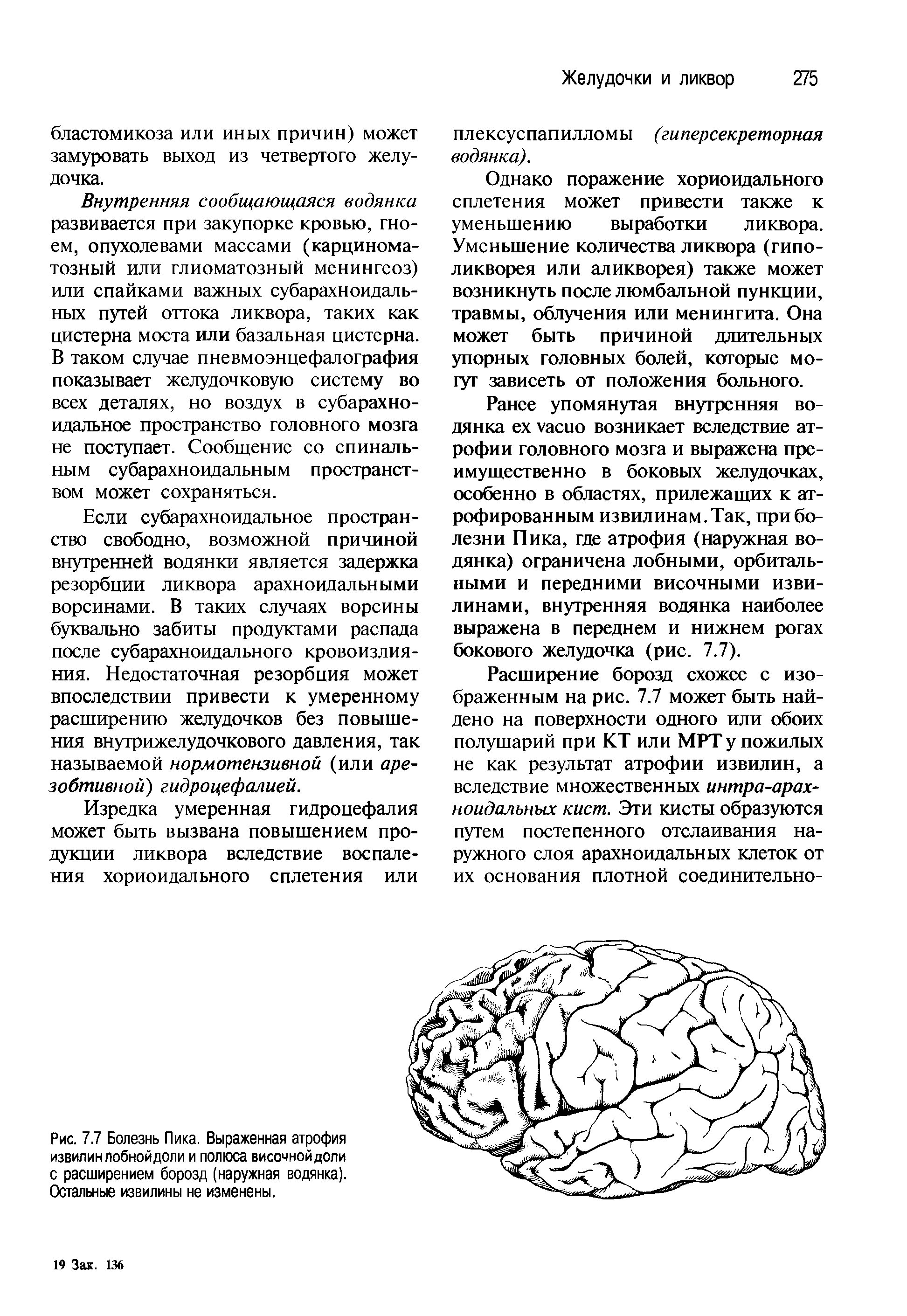 Рис. 7.7 Болезнь Пика. Выраженная атрофия извилин лобной доли и полюса височной доли с расширением борозд (наружная водянка). Остальные извилины не изменены.