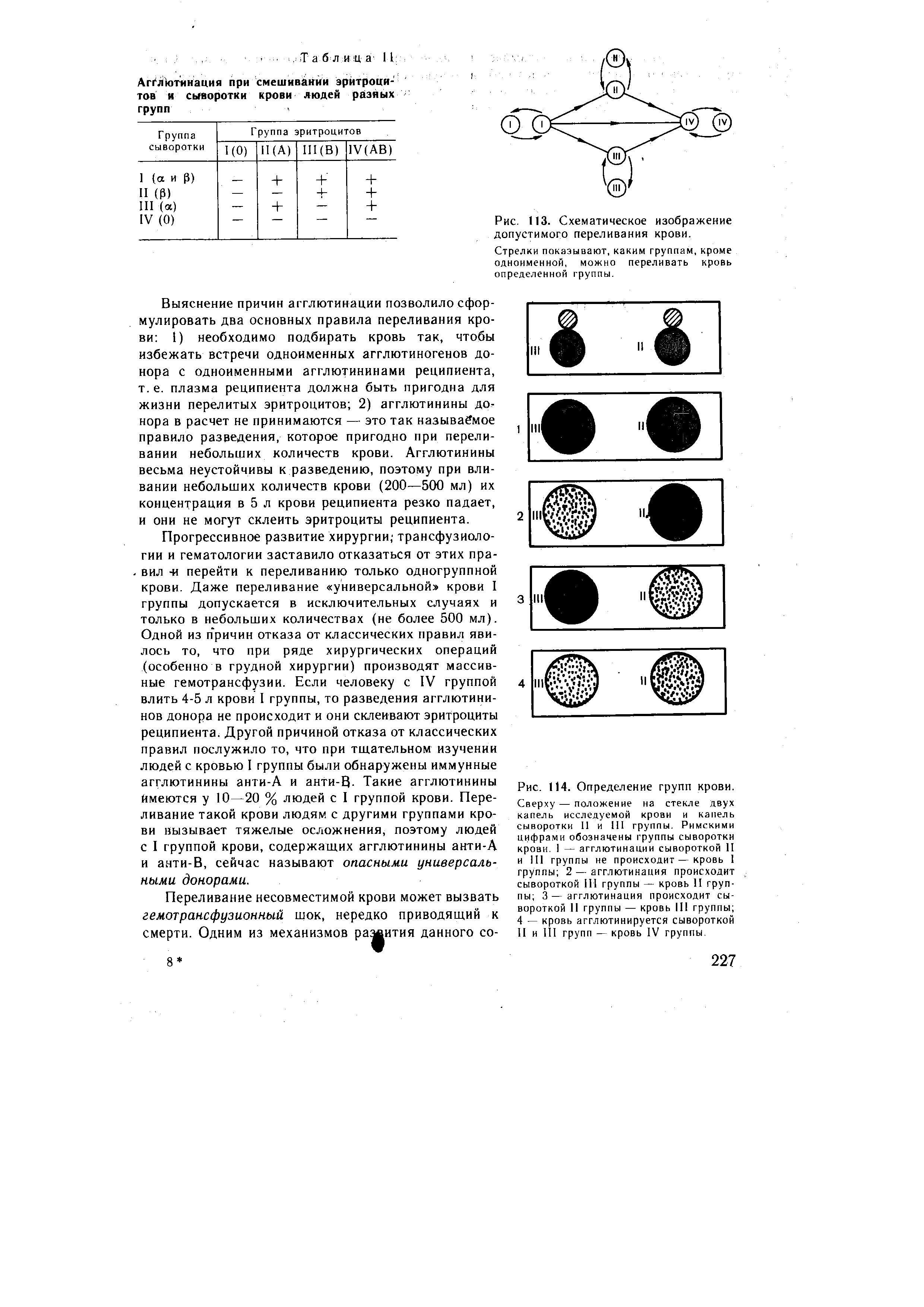 Рис. 114. Определение групп крови. Сверху — положение на стекле двух капель исследуемой крови и капель сыворотки II и III группы. Римскими цифрами обозначены группы сыворотки крови. I — агглютинации сывороткой II и 111 группы не происходит—кровь 1 группы 2 — агглютинация происходит сывороткой III группы — кровь II группы 3 — агглютинация происходит сывороткой 11 группы — кровь III группы 4 — кровь агглютинируется сывороткой II и III групп — кровь IV группы.
