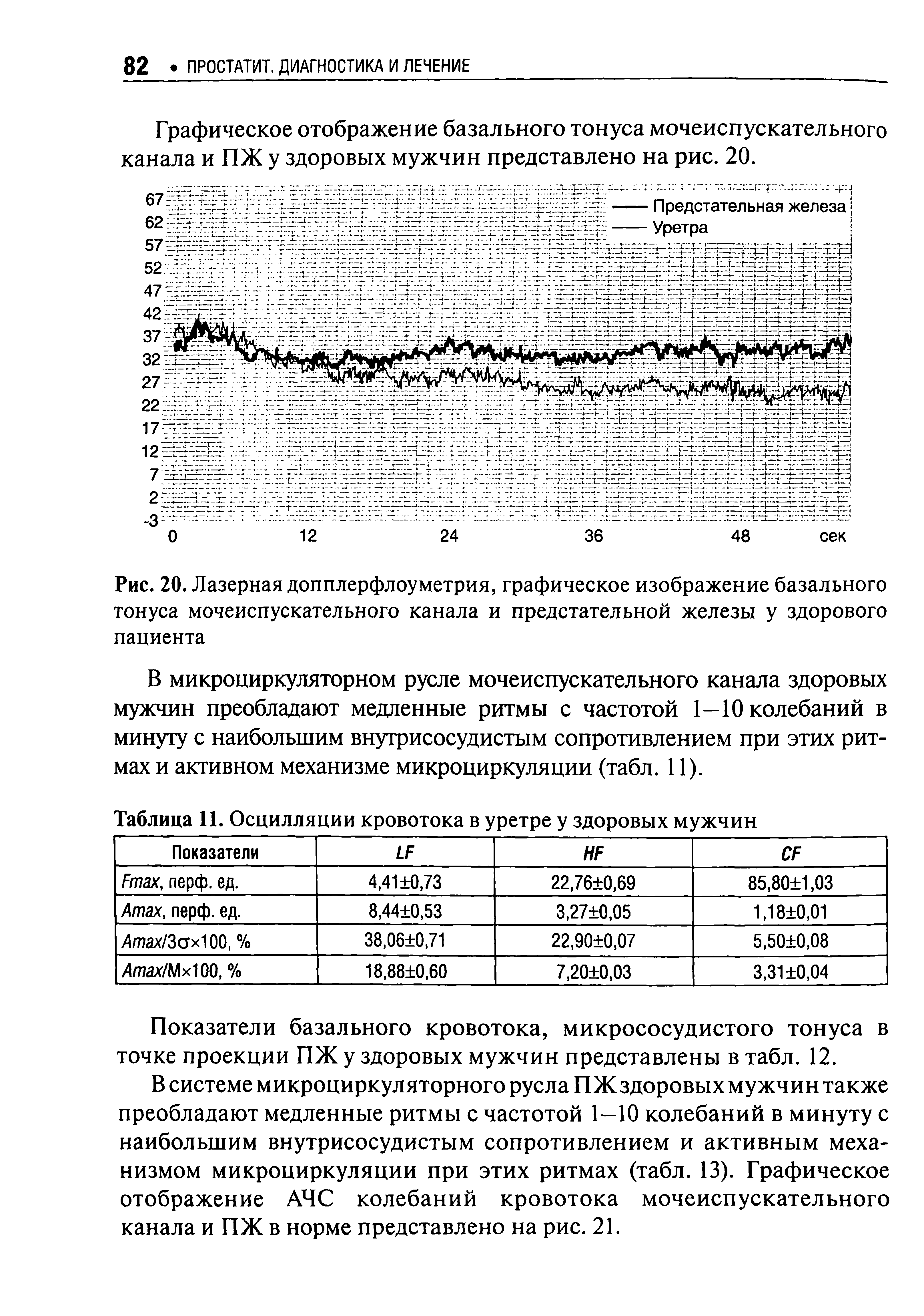 Рис. 20. Лазерная допплерфлоуметрия, графическое изображение базального тонуса мочеиспускательного канала и предстательной железы у здорового пациента...