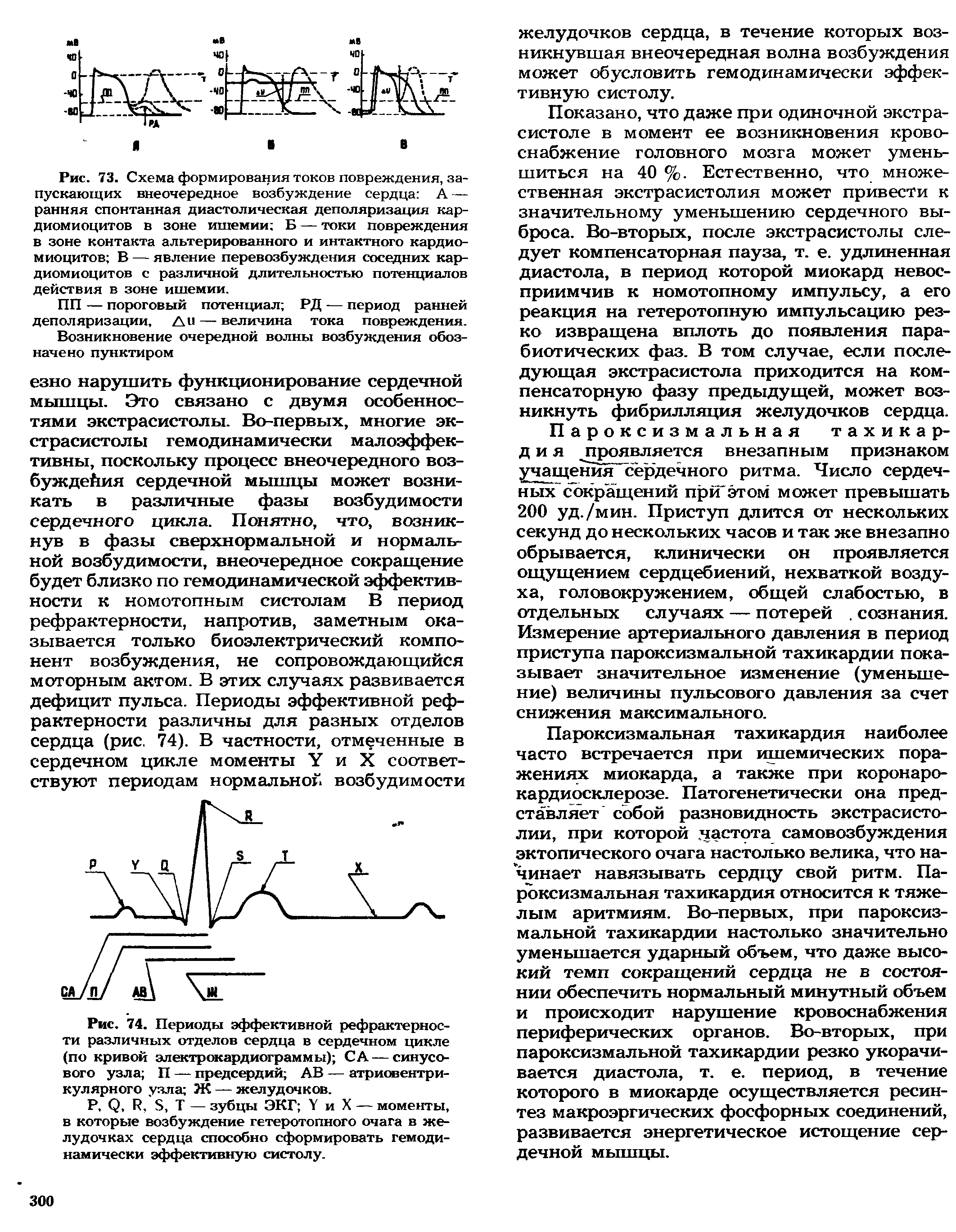 Рис. 74. Периоды эффективной рефрактерности различных отделов сердца в сердечном цикле (по кривой электрокардиограммы) С А — синусового узла П — предсердий АВ — атриовентрикулярного узла Ж — желудочков.