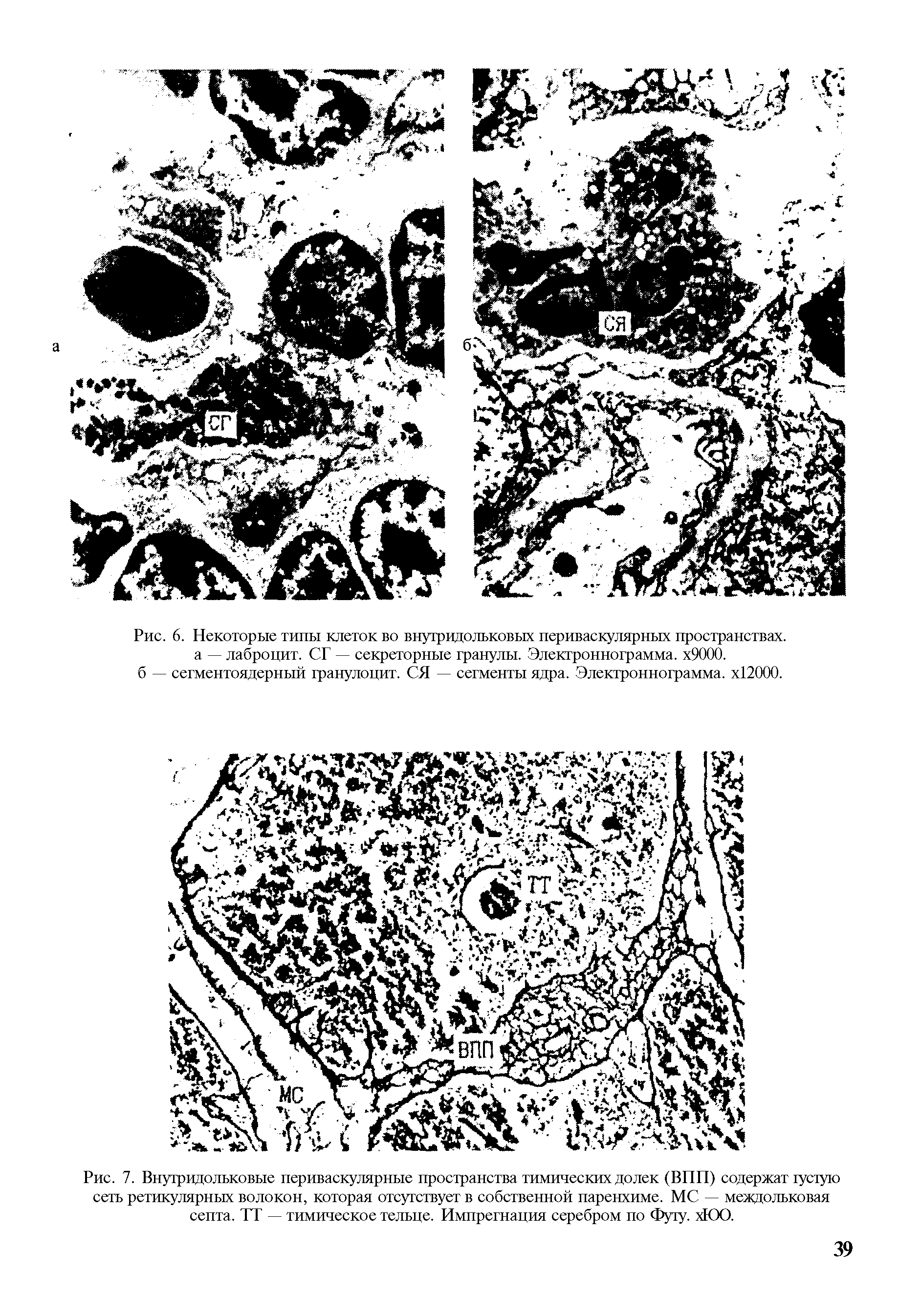 Рис. 7. Внутридольковые периваскулярные пространства тимических долек (ВПП) содержат густую сеть ретикулярных волокон, которая отсутствует в собственной паренхиме. МС — междольковая септа. ТТ — тимическое тельце. Импрегнация серебром по Футу. хЮО.