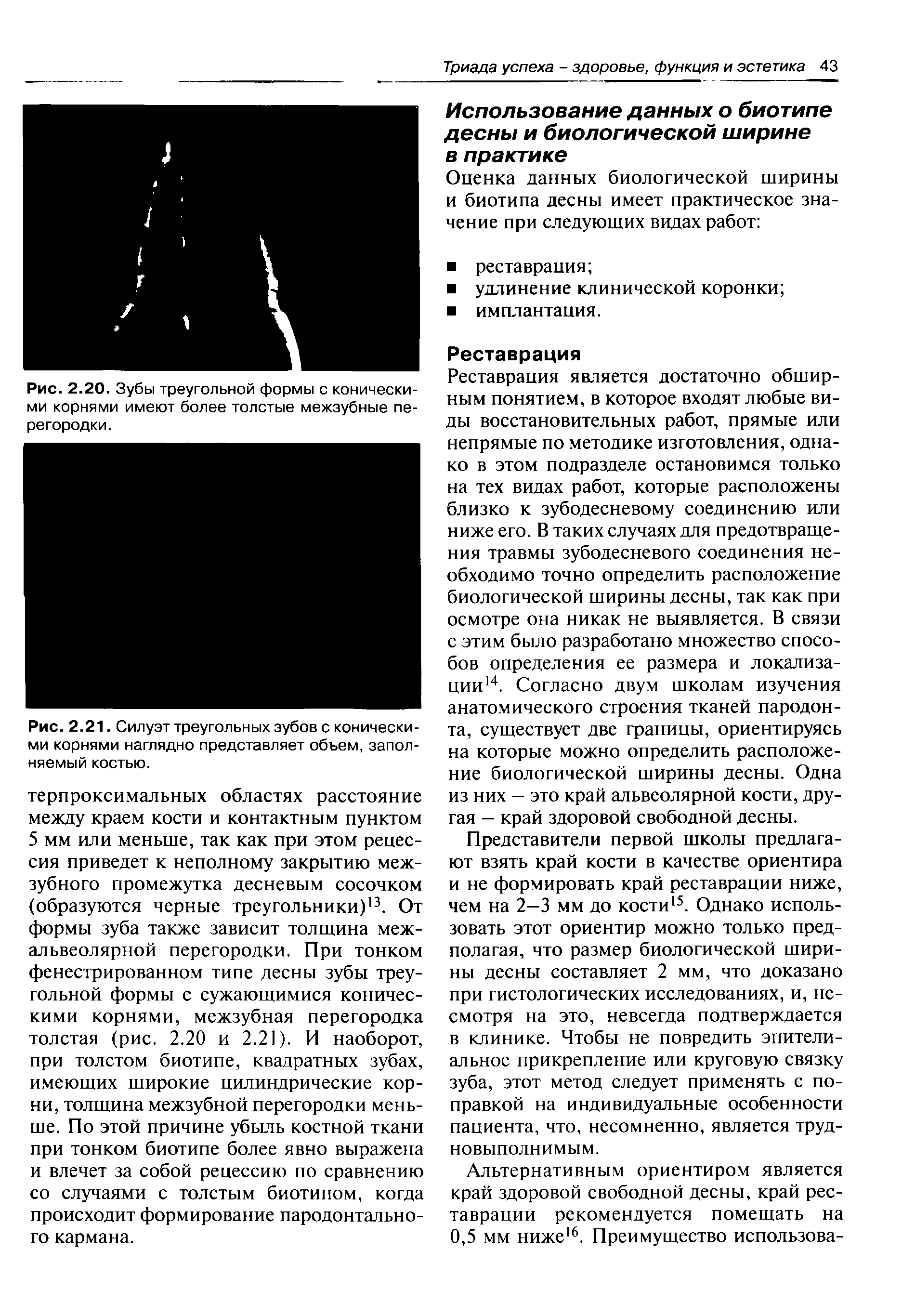 Рис. 2.20. Зубы треугольной формы с коническими корнями имеют более толстые межзубные перегородки.