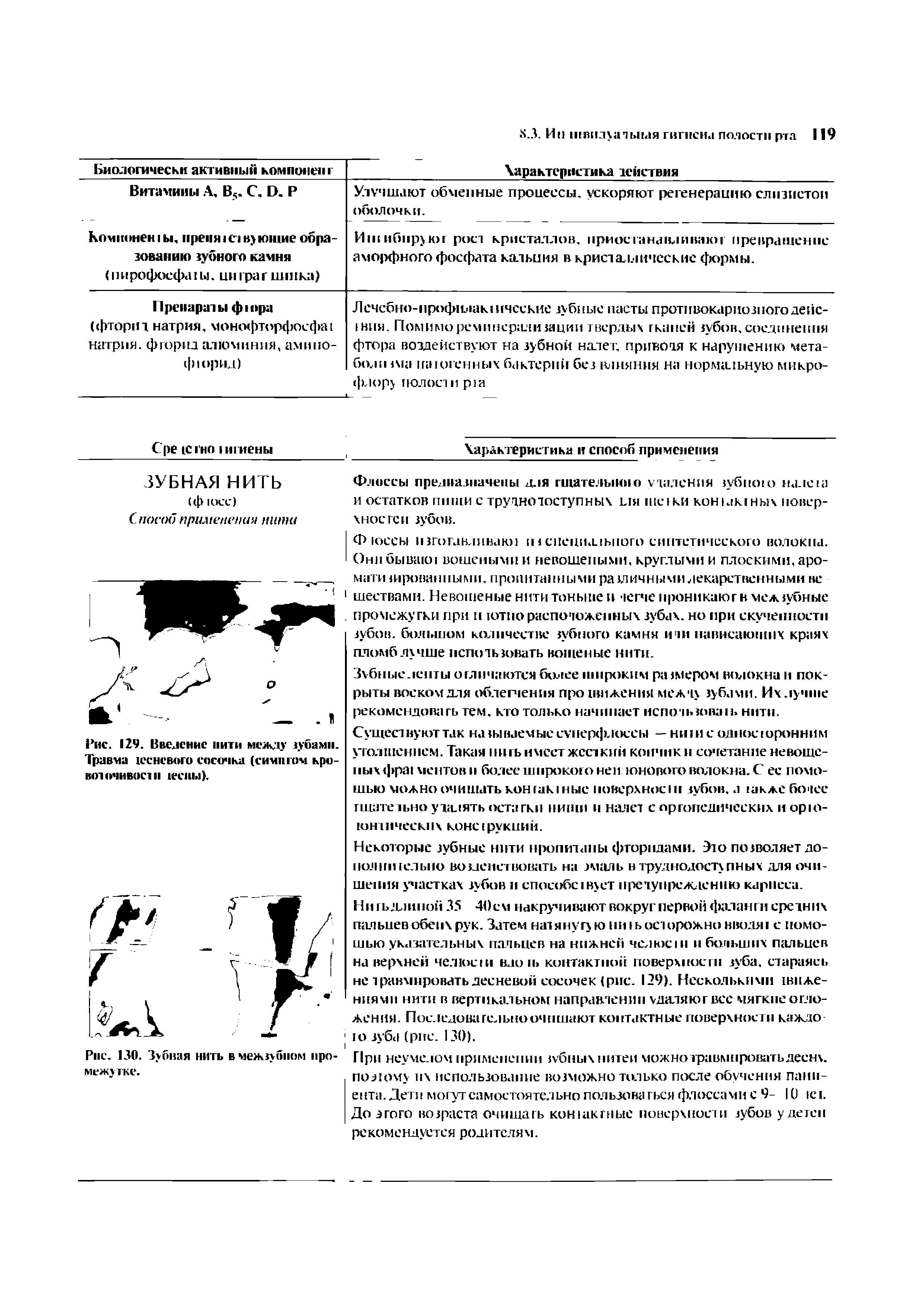 Рис. 129. Введение нити между зубами. Травма тесневого сосочка (симптом кровоточиво в ).