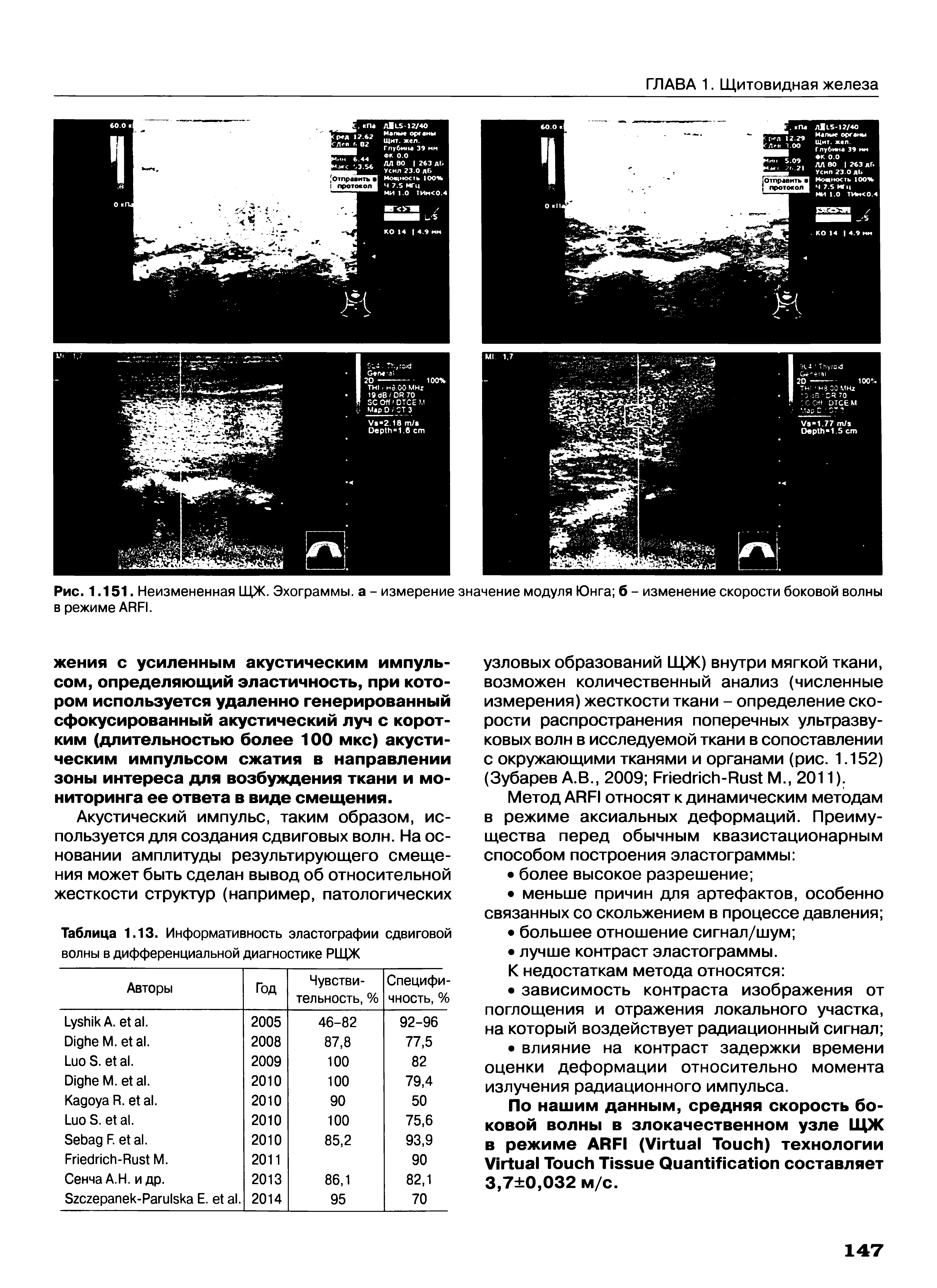 Таблица 1.13. Информативность эластографии сдвиговой волны в дифференциальной диагностике РИДЖ...