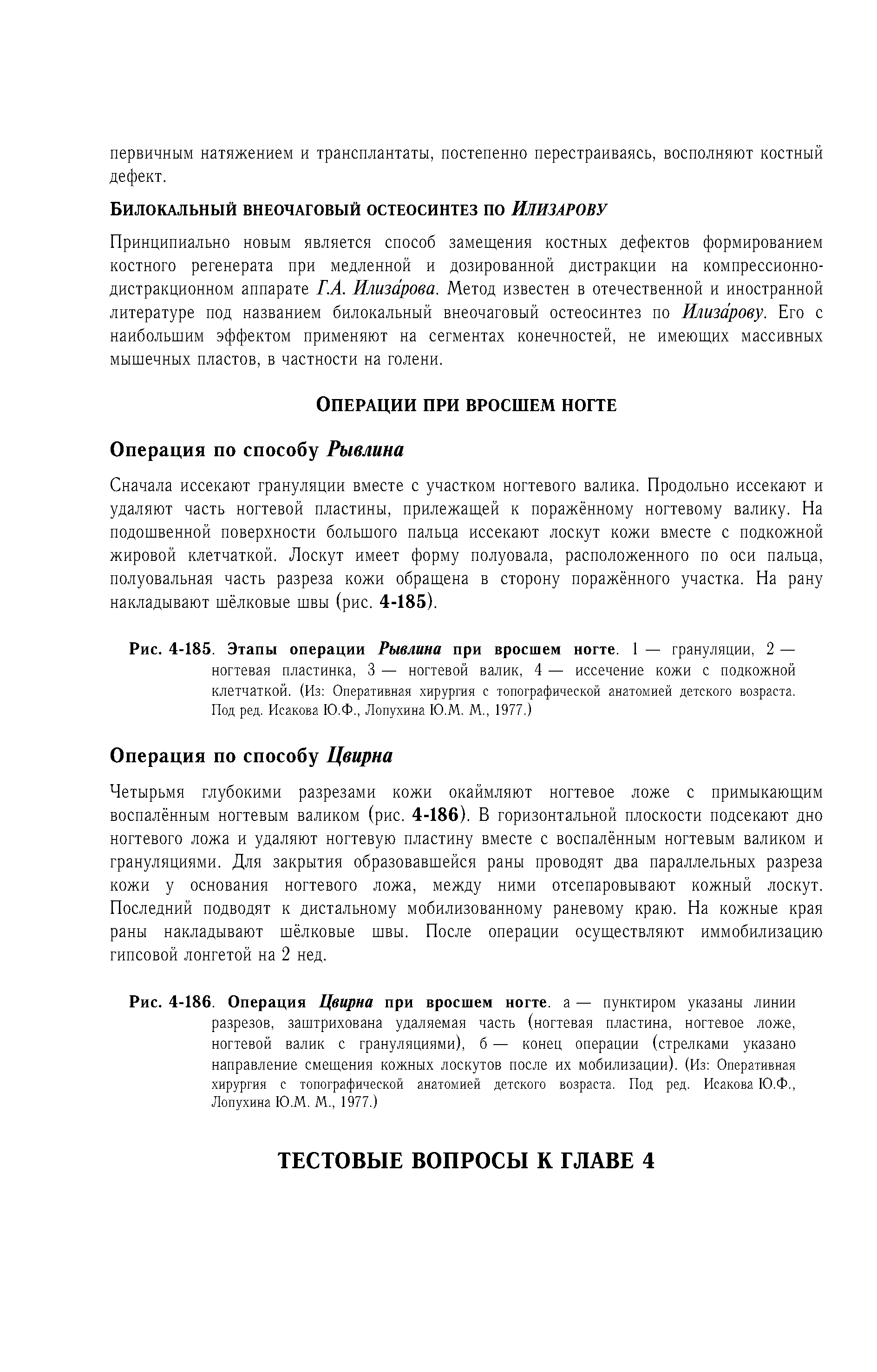 Рис. 4-185. Этапы операции Рывлина при вросшем ногте. 1 — грануляции, 2 — ногтевая пластинка, 3 — ногтевой валик, 4 — иссечение кожи с подкожной клетчаткой. (Из Оперативная хирургия с топографической анатомией детского возраста. Под ред. Исакова Ю.Ф., Лопухина Ю.М. М., 1977.)...