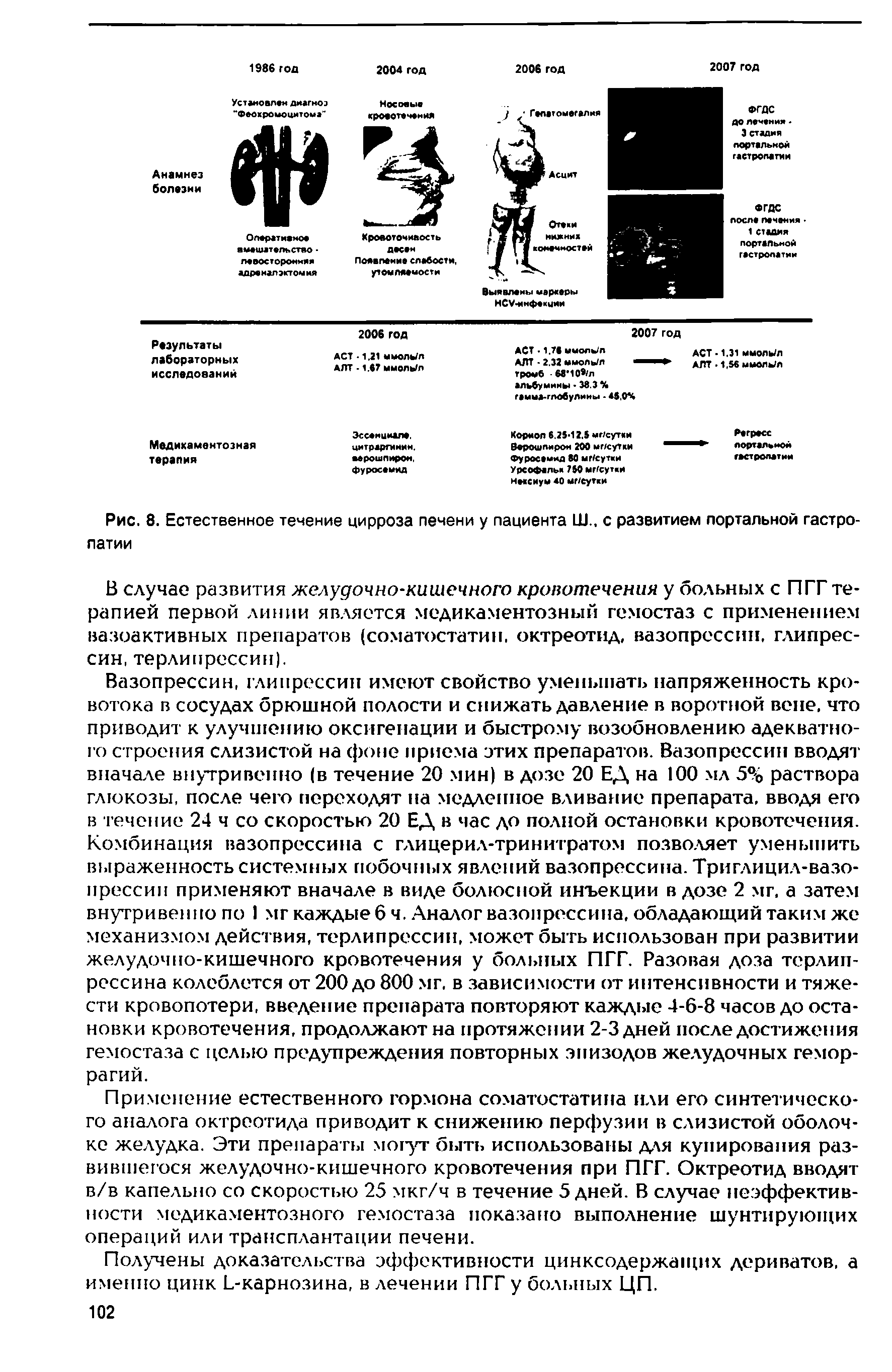 Рис. 8. Естественное течение цирроза печени у пациента Ш., с развитием портальной гастропатии...