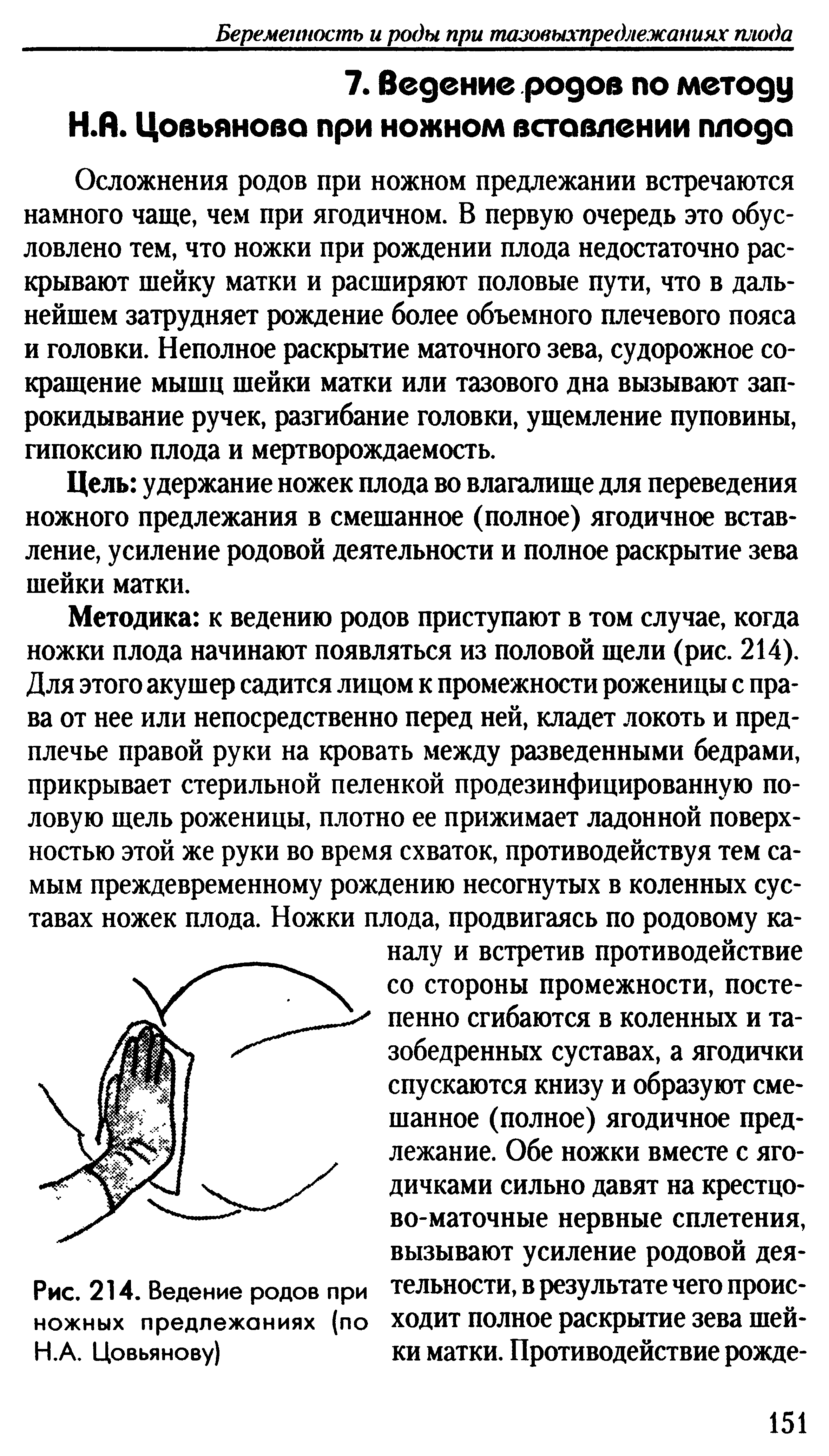 Рис. 214. Ведение родов при тельности, в результате чего проис-ножных предлежаниях (по ходит полное раскрытие зева шей-Н.А. Цовьянову) ки матки. Противодействие рожде-...