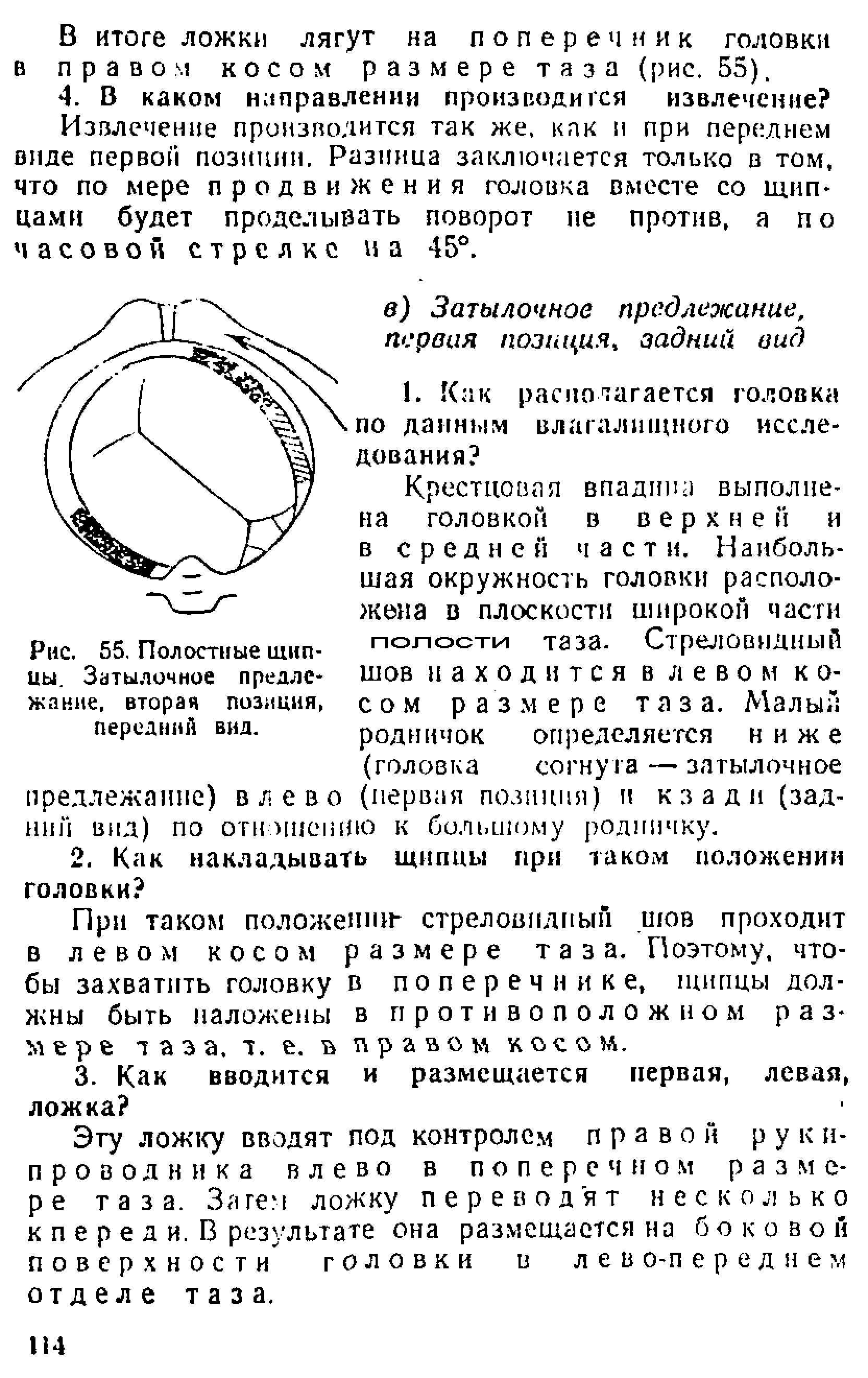 Рис. 55. Полостные щипцы. Затылочное предлежание, вторая позиция, передний вид.