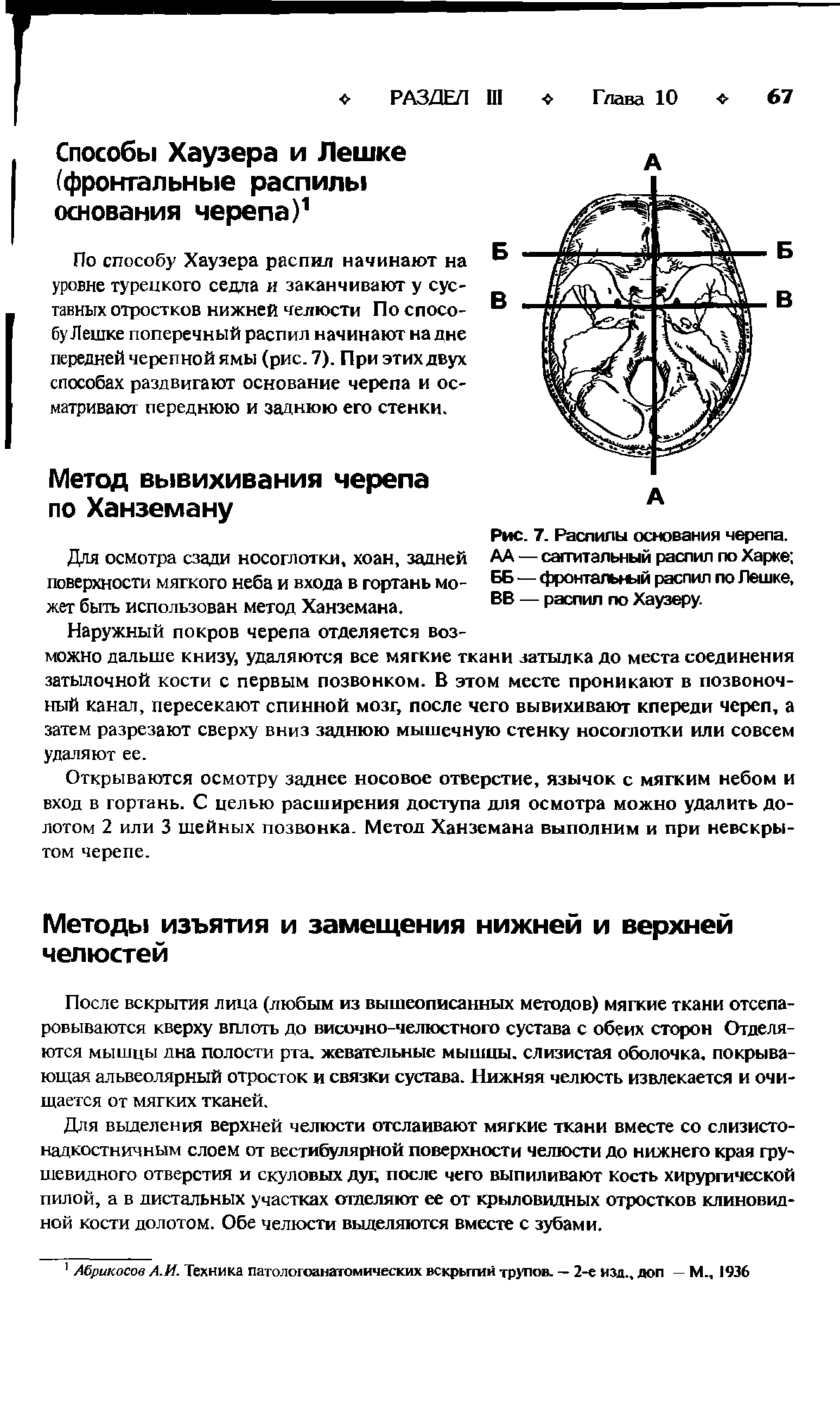 Рис. 7. Распилы основания черепа. АА — сагтитальный распил по Харке ББ — фронтальный распил по Лешке, ВВ — распил по Хаузеру.