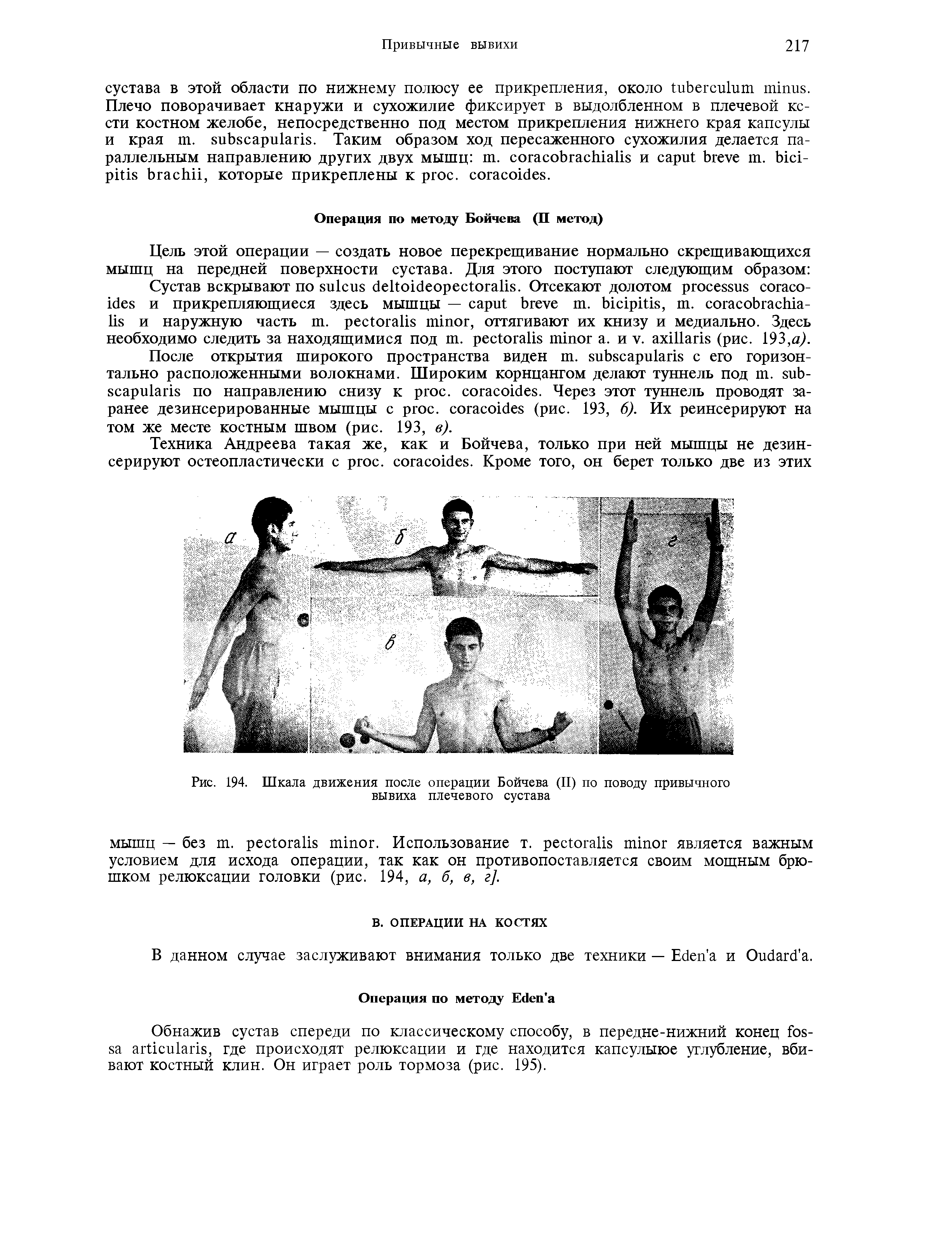 Рис. 194. Шкала движения после операции Бойчева (II) по поводу привычного вывиха плечевого сустава...