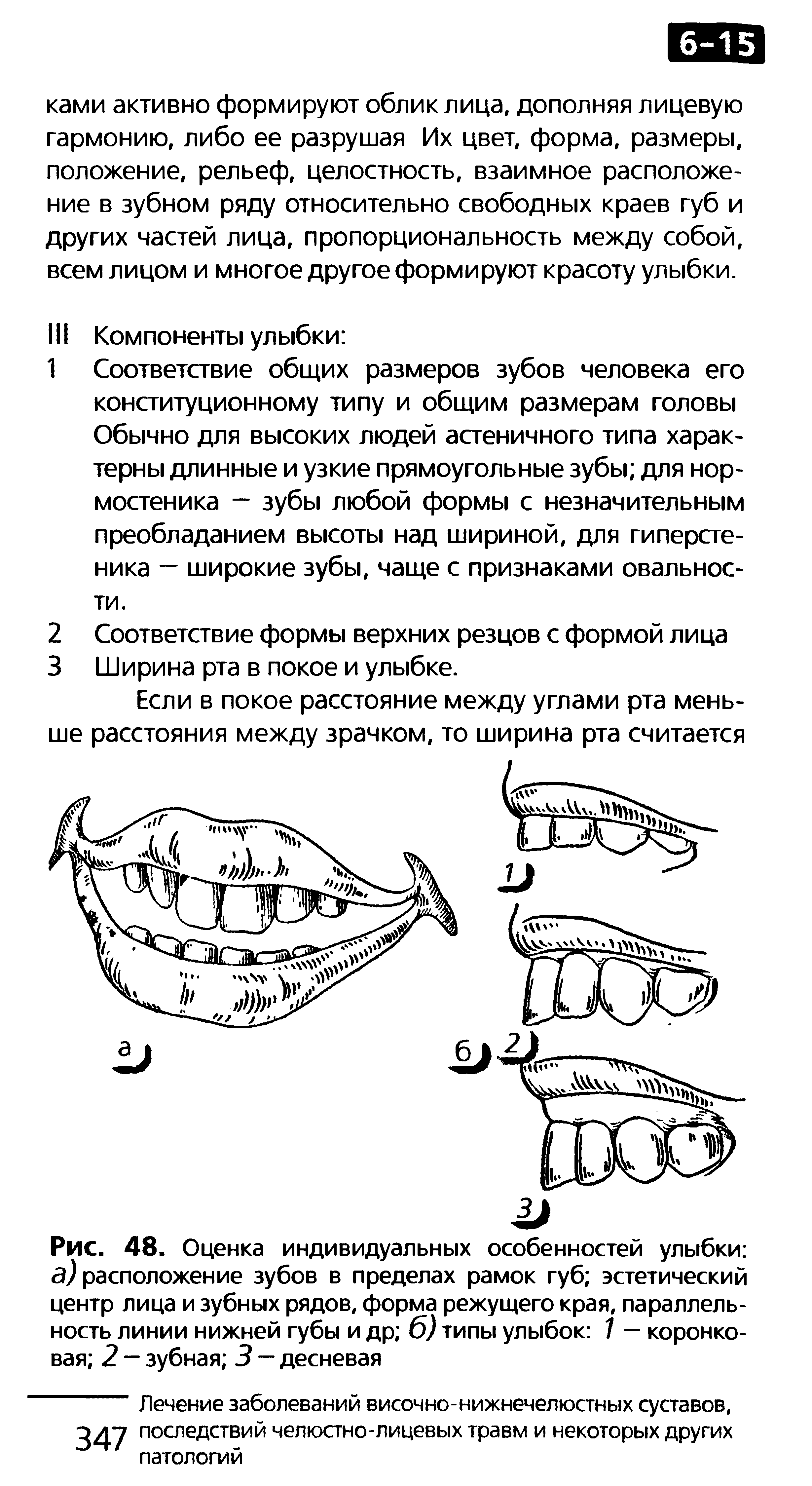 Рис. 48. Оценка индивидуальных особенностей улыбки а) расположение зубов в пределах рамок губ эстетический центр лица и зубных рядов, форма режущего края, параллельность линии нижней губы и др б) типы улыбок 7 — коронковая 2 - зубная 3 — десневая...