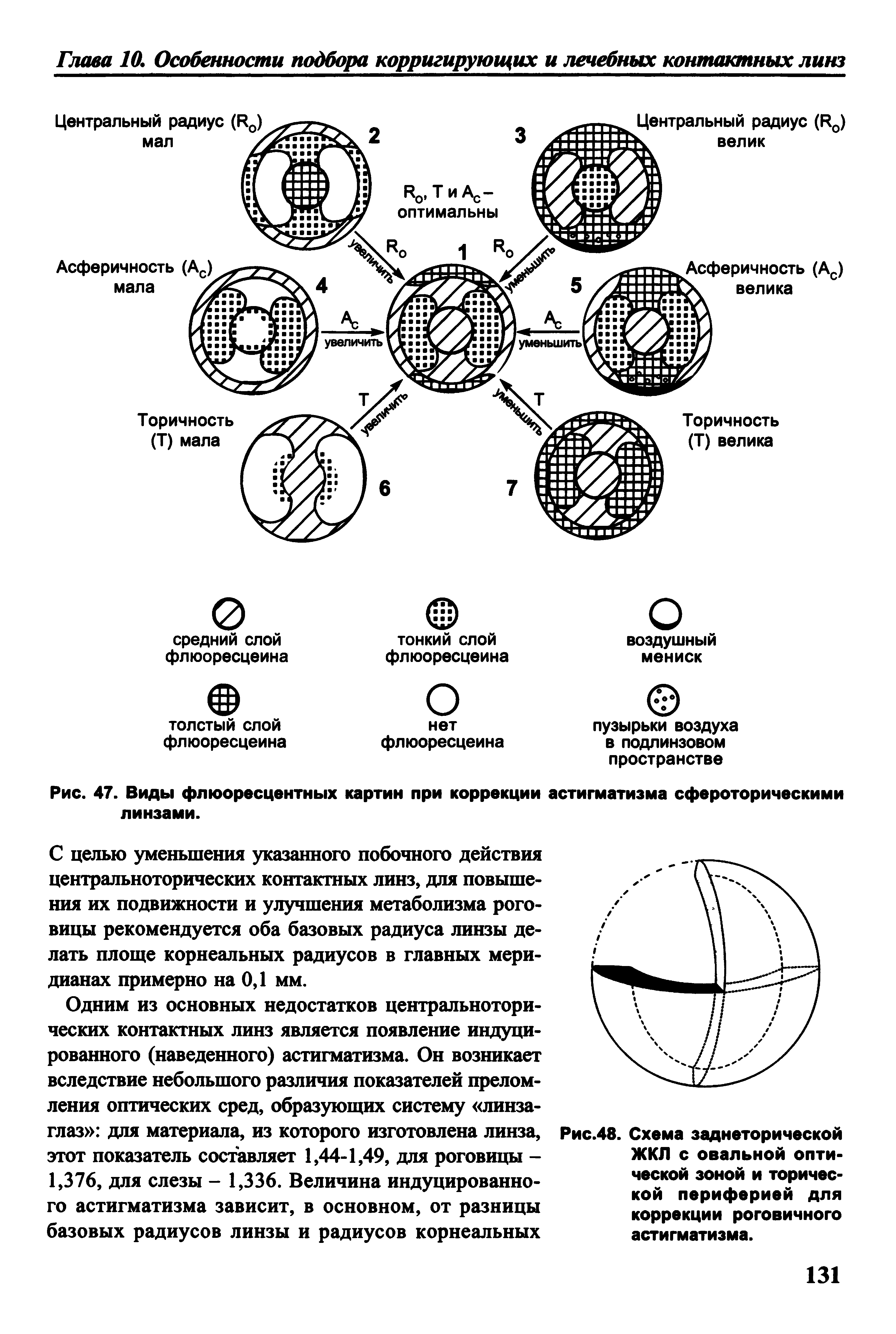 Рис.48. Схема заднеторической ЖКЛ с овальной оптической зоной и торичес-кой периферией для коррекции роговичного астигматизма.