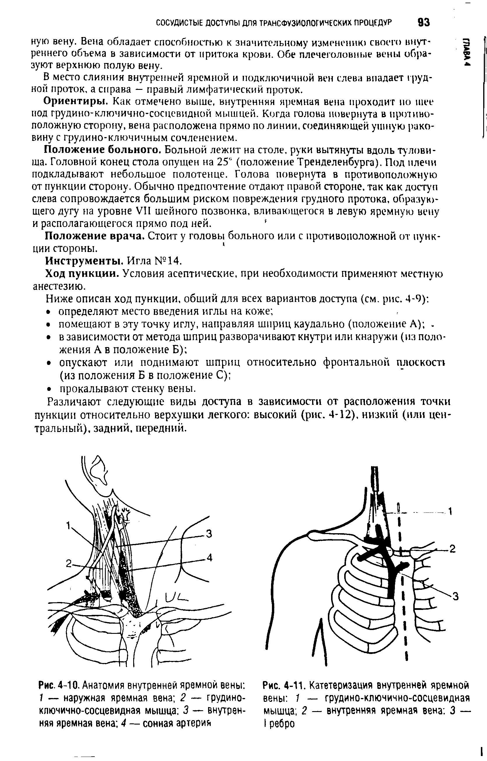 Рис. 4-11. Катетеризация внутренней яремной вены 1 — грудино-ключично-сосцевидная мышца 2 — внутренняя яремная вена 3 — I ребро...