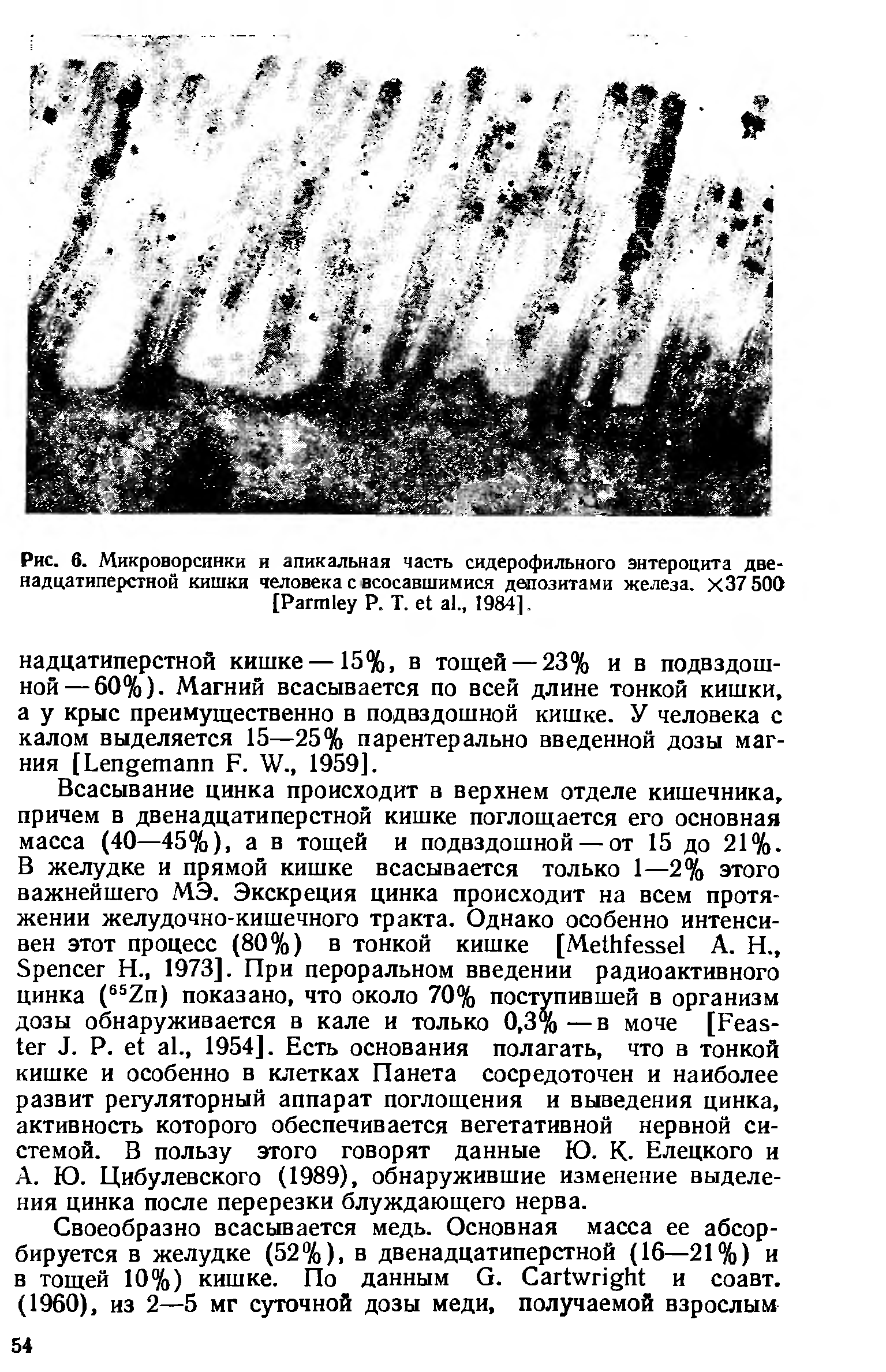 Рис. 6. Микроворсинки и апикальная часть сидерофильного энтероцита двенадцатиперстной кишки человека с всосавшимися депозитами железа. Х37 50О [Рагт1еу Р. Т. е1 а1., 1984].